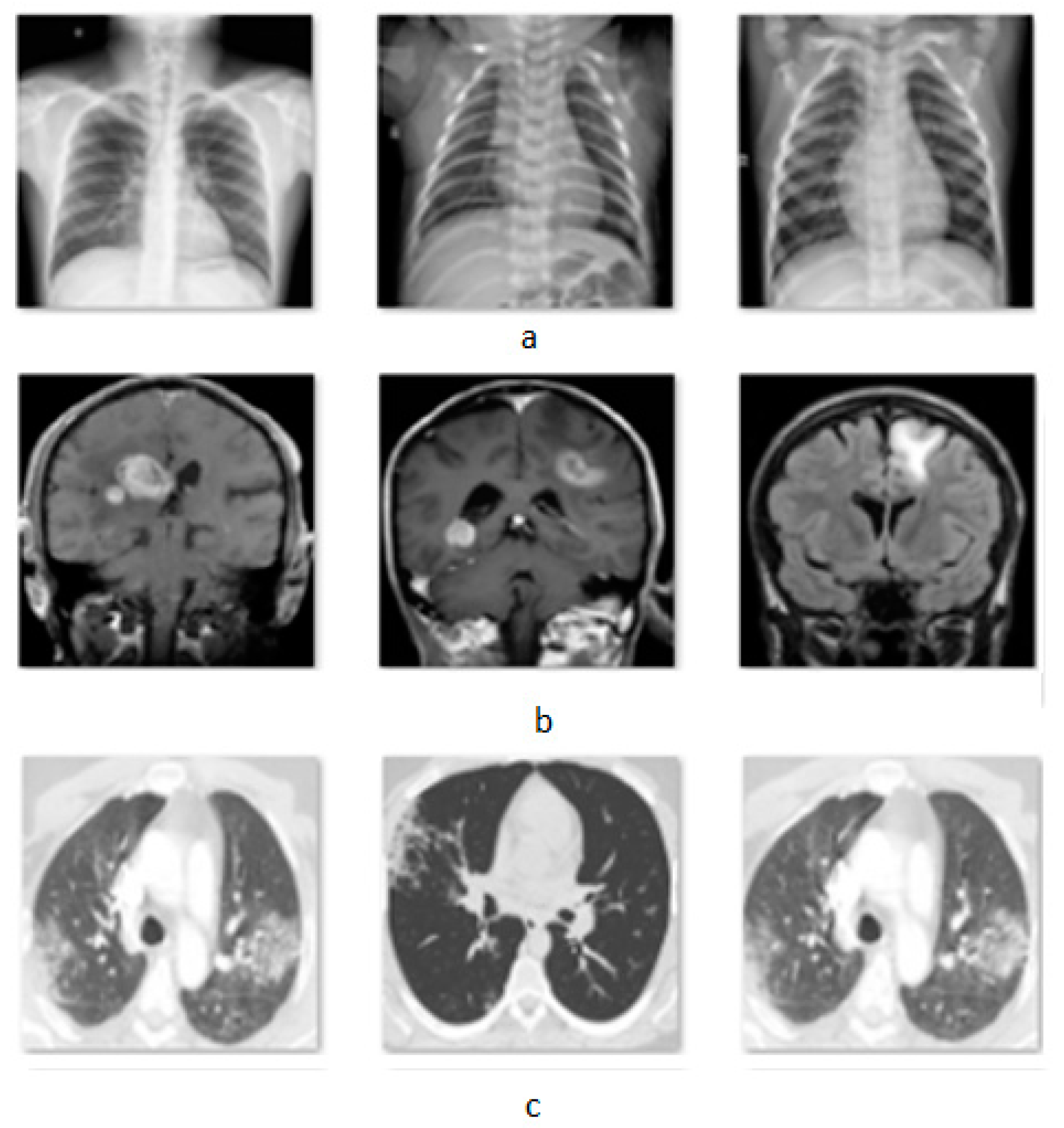 Jimaging 08 00155 g002 550