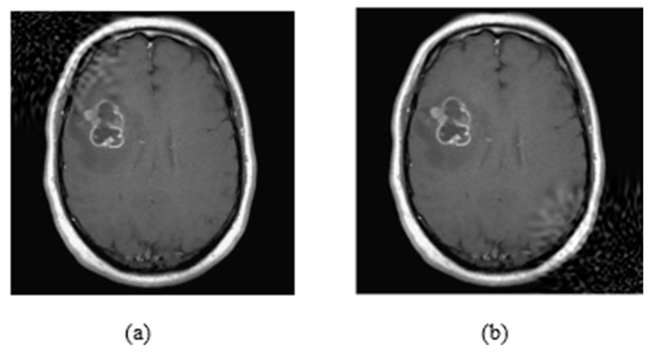 Jimaging 08 00155 g003 550