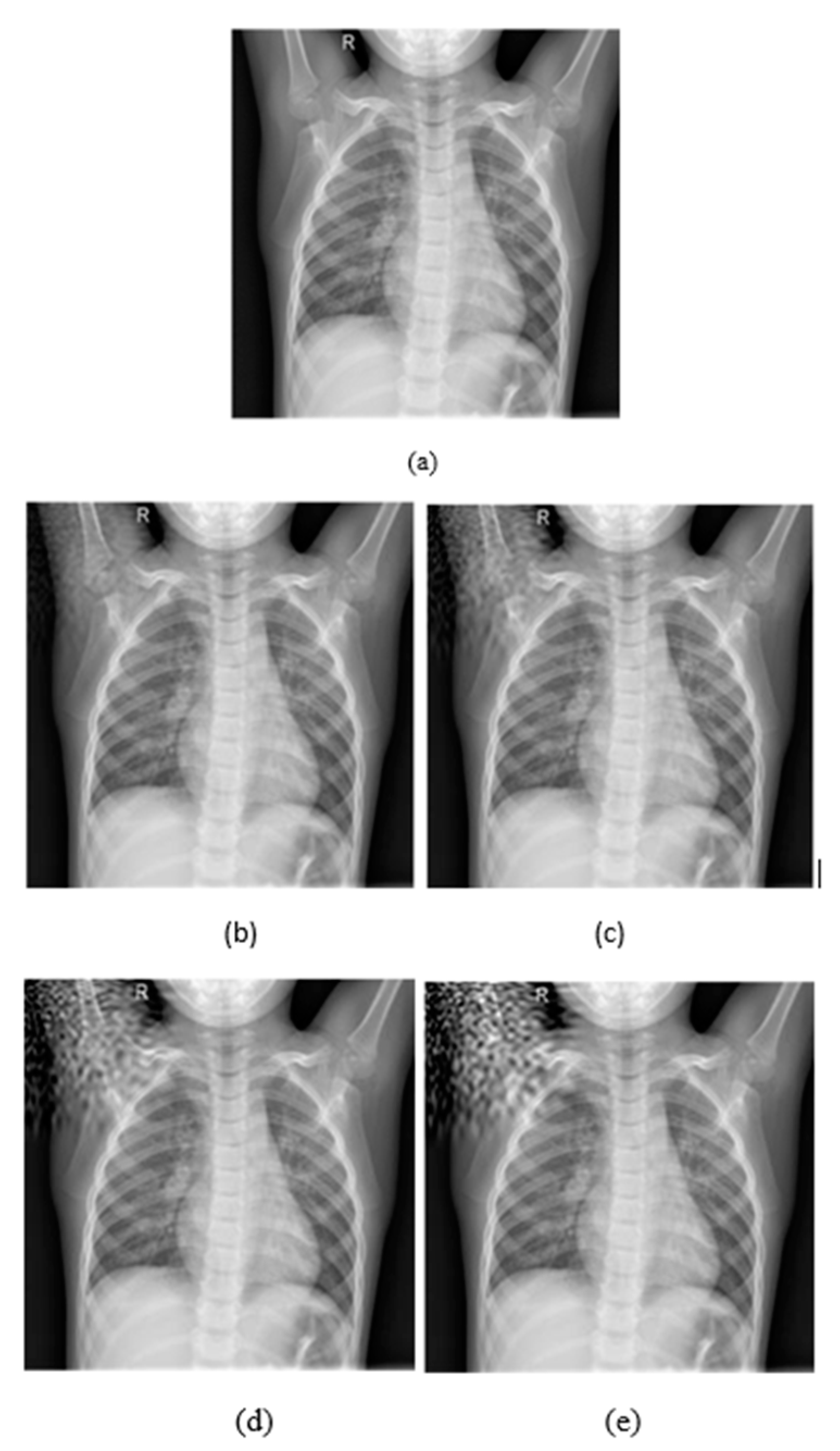 Jimaging 08 00155 g004 550
