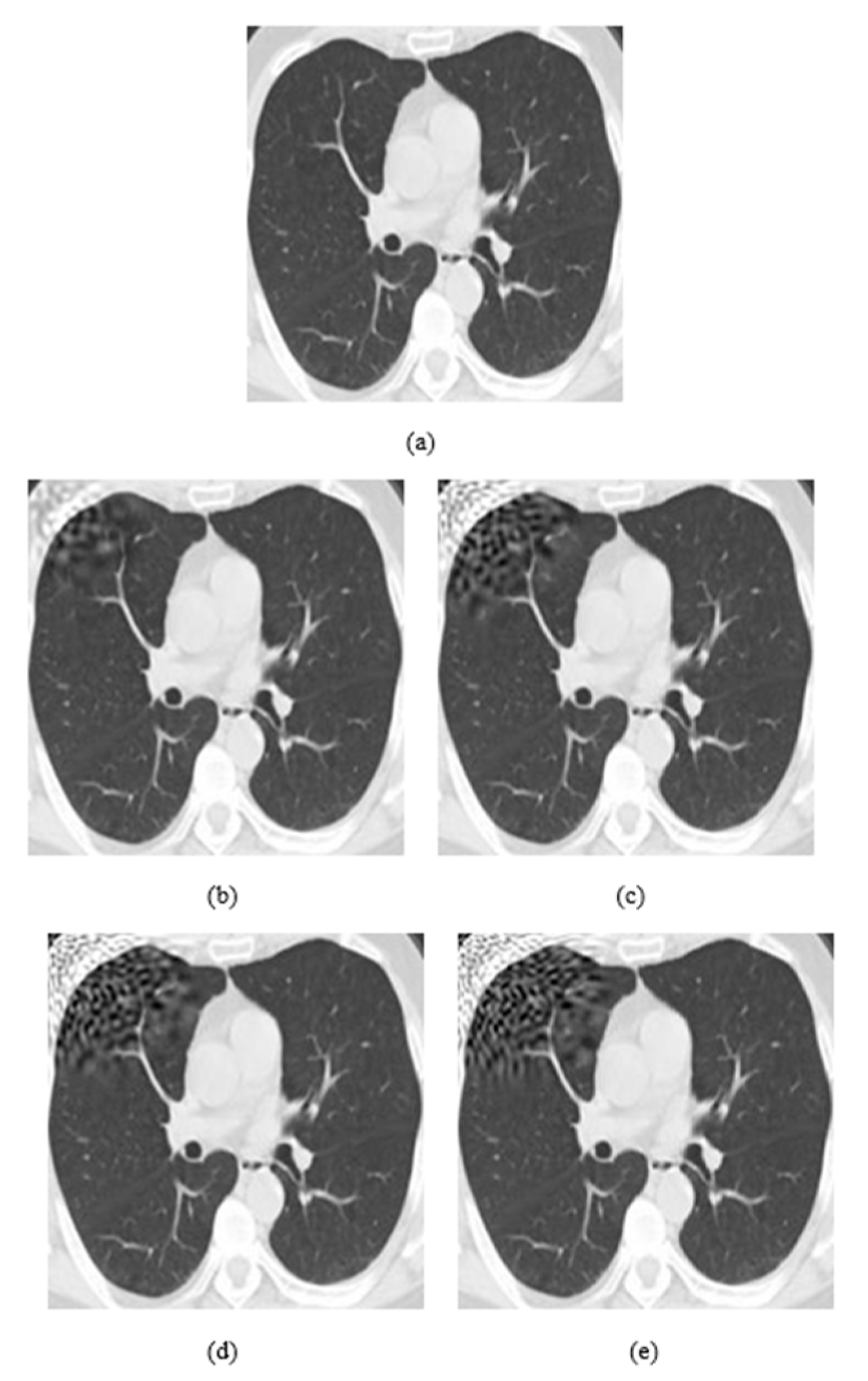 Jimaging 08 00155 g005 550