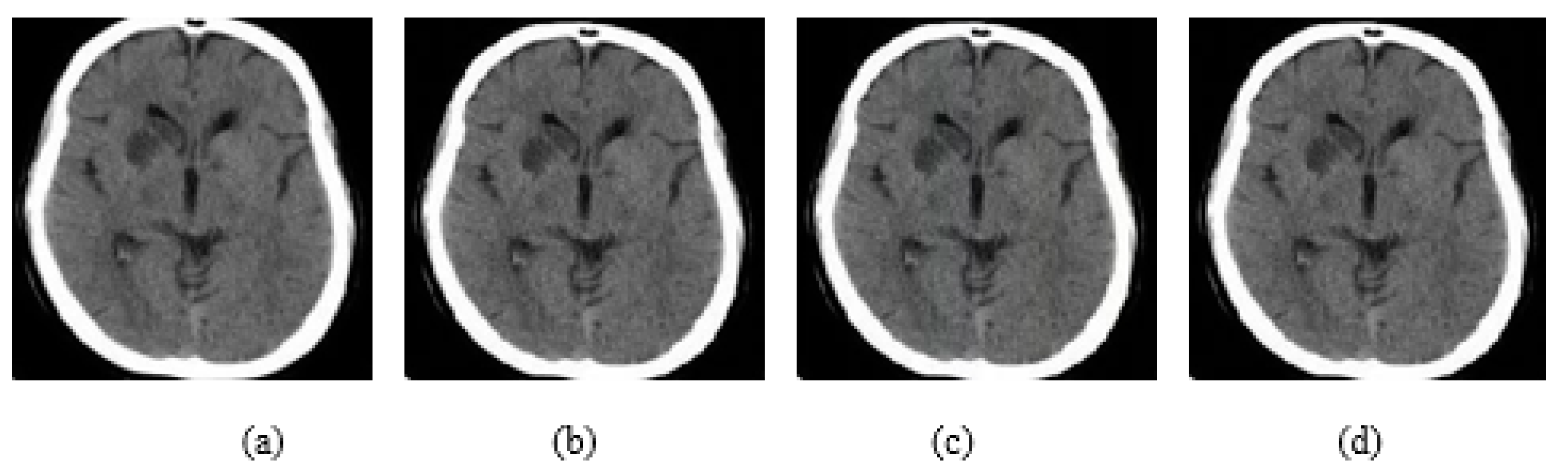 Jimaging 08 00155 g006 550