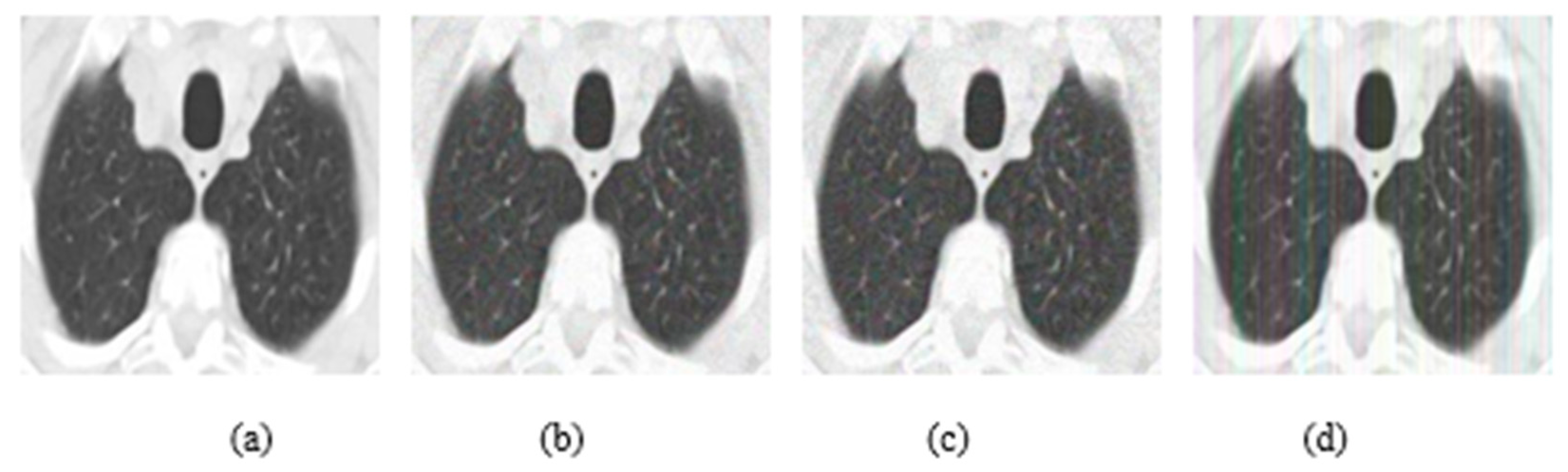 Jimaging 08 00155 g007 550