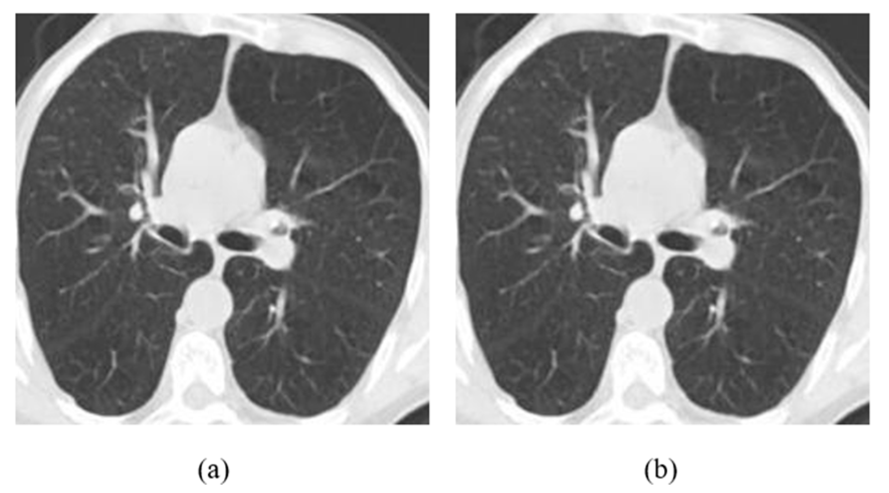 Jimaging 08 00155 g009 550