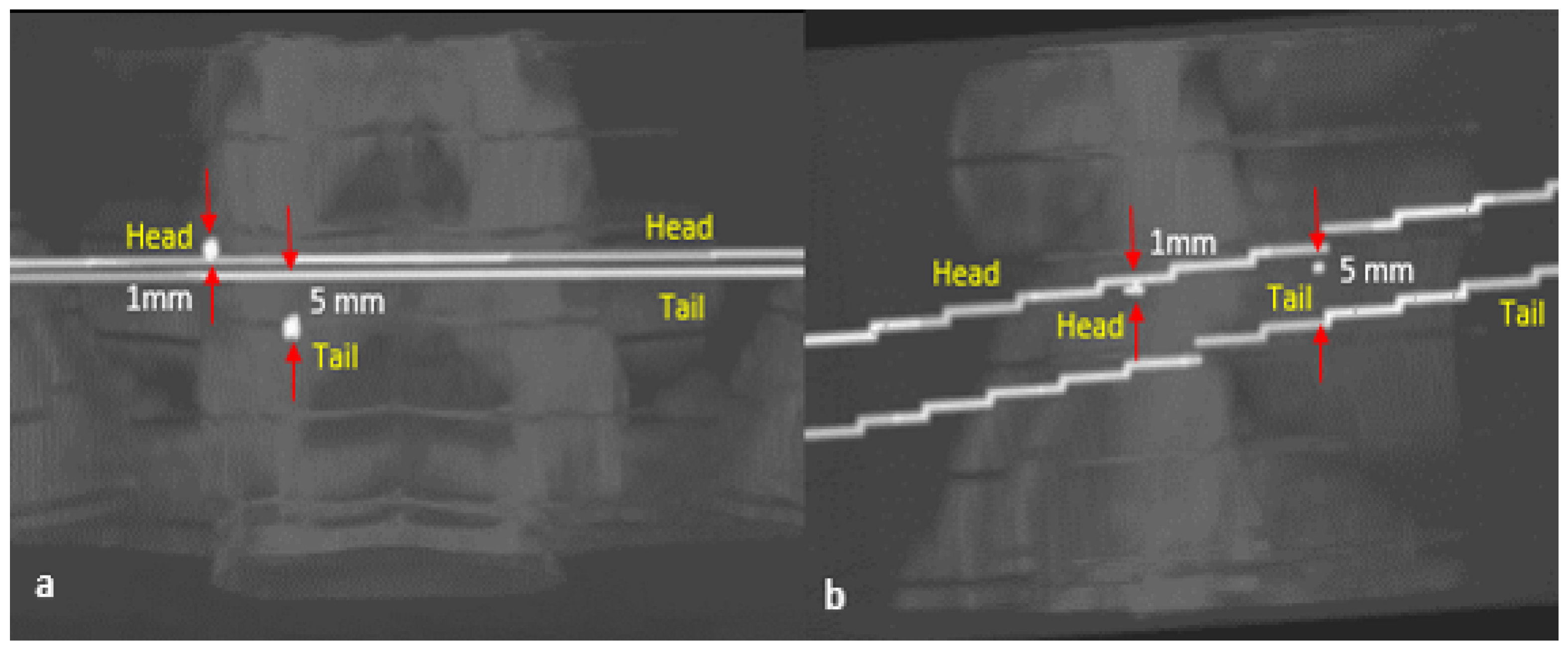 Jimaging 08 00185 g004 Jimaging 08 00185 g004