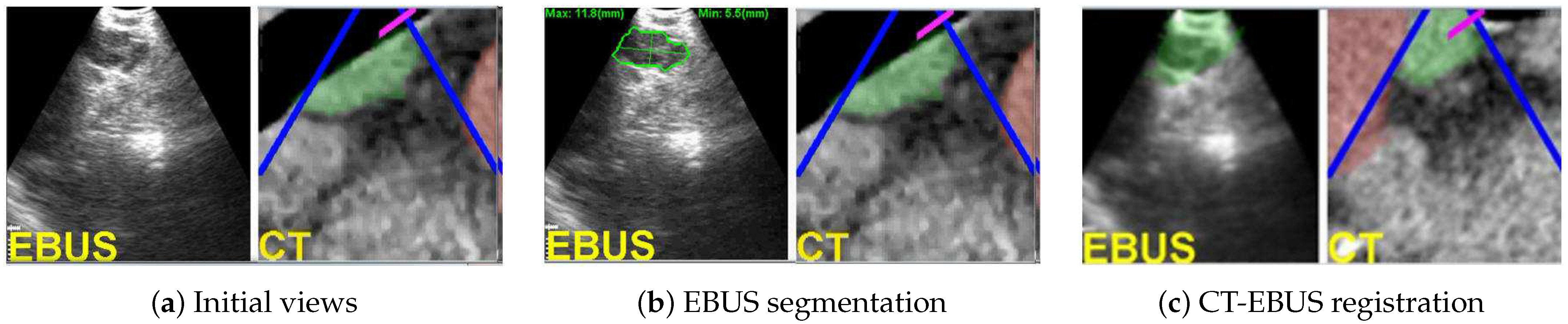 Jimaging 08 00189 g005