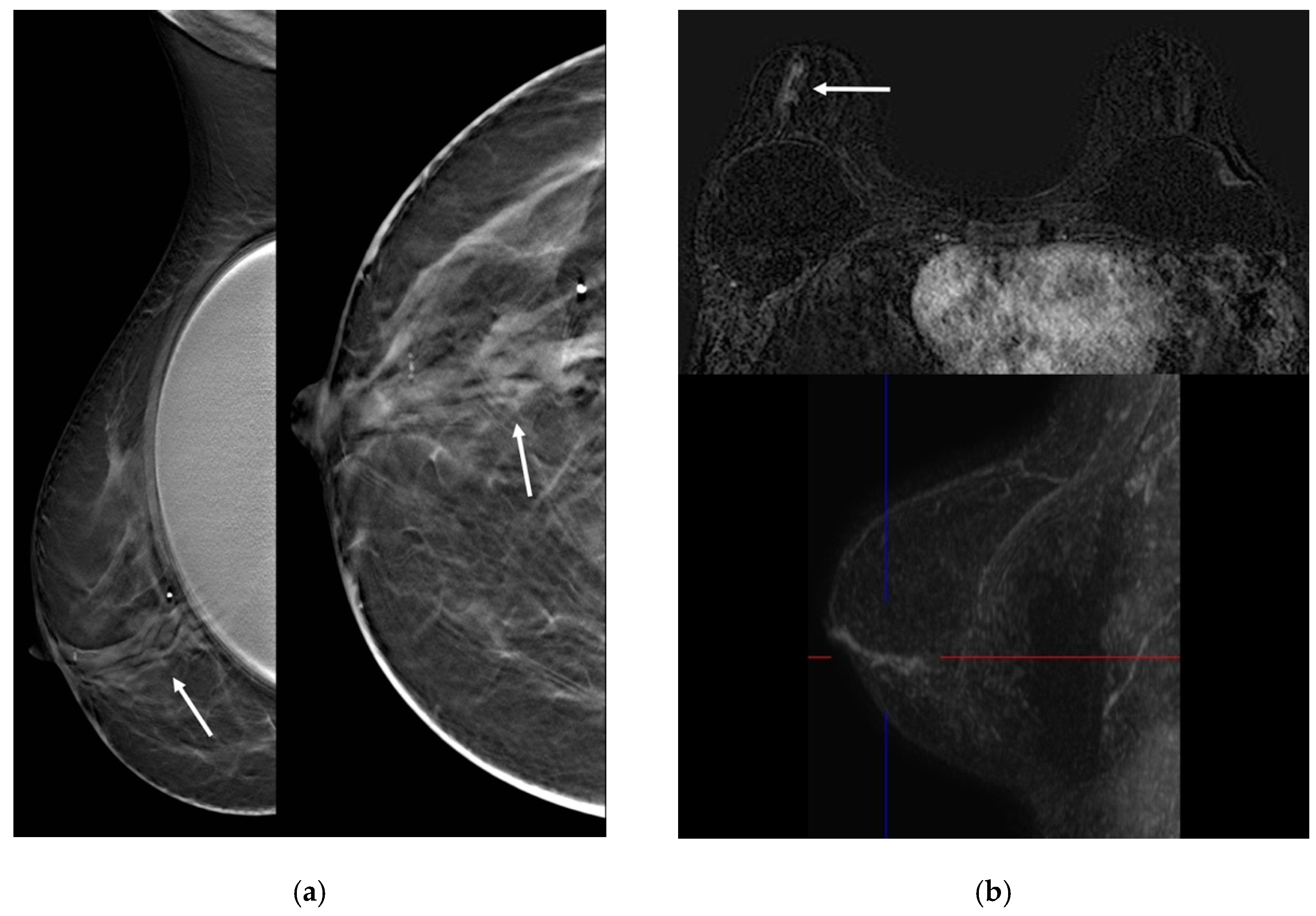 Jimaging 08 00198 g003 550