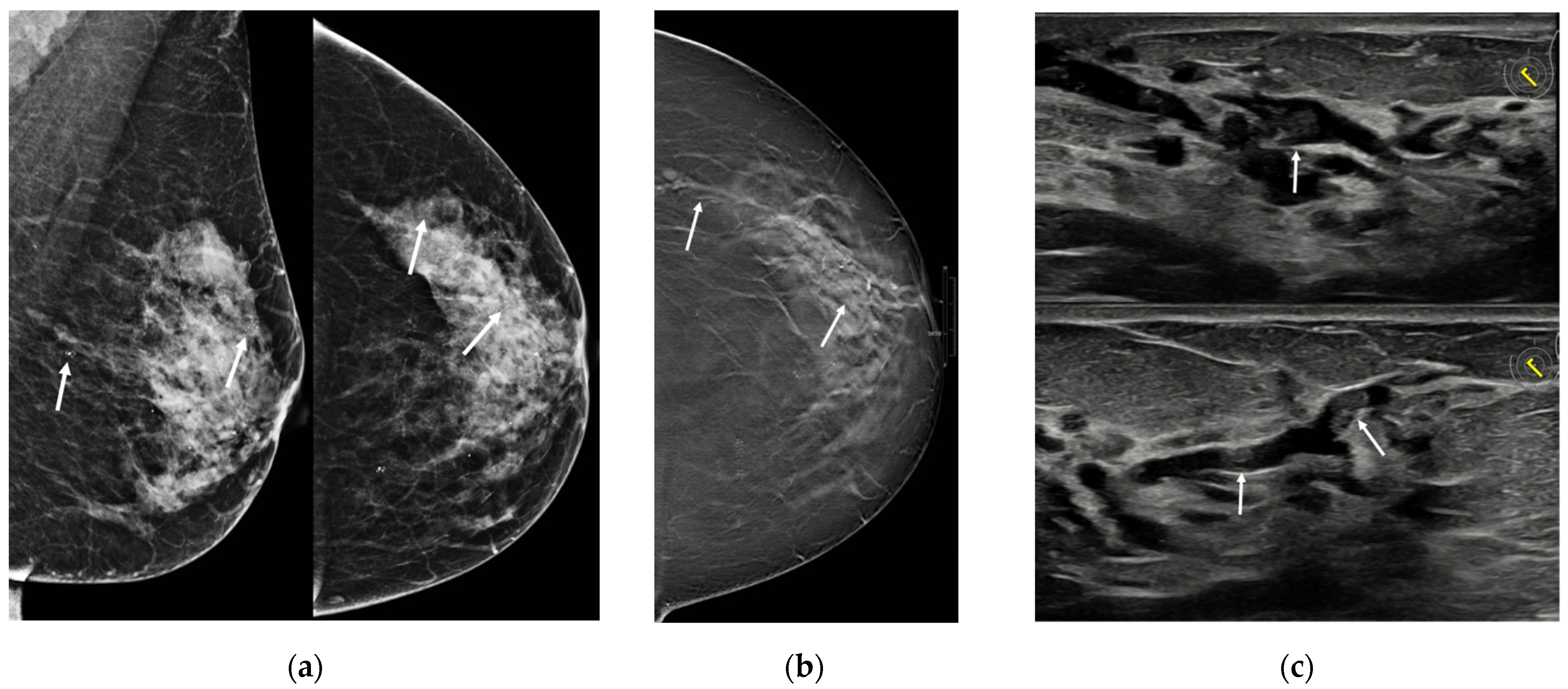 Jimaging 08 00198 g004 550