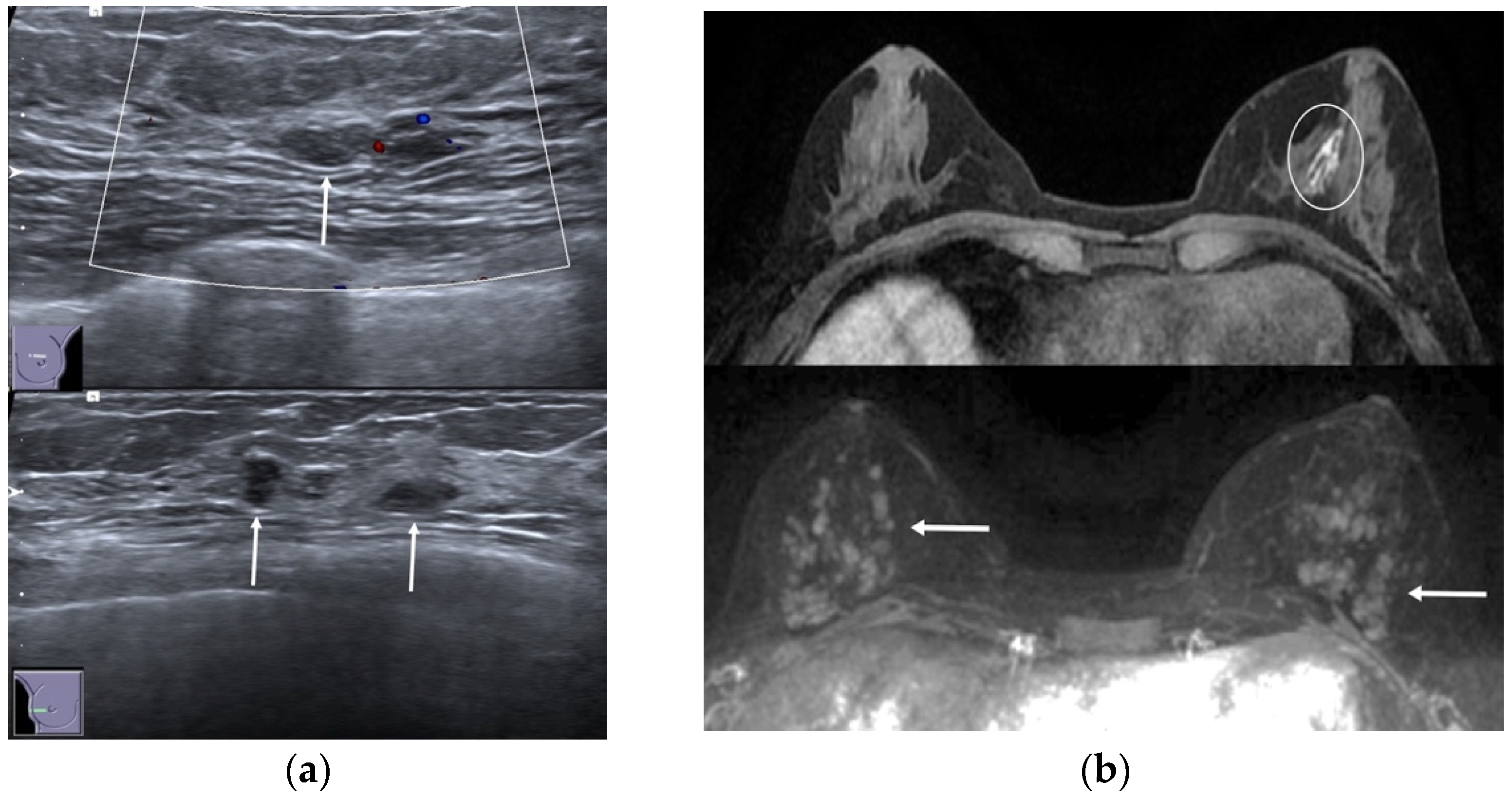 Jimaging 08 00198 g005 550
