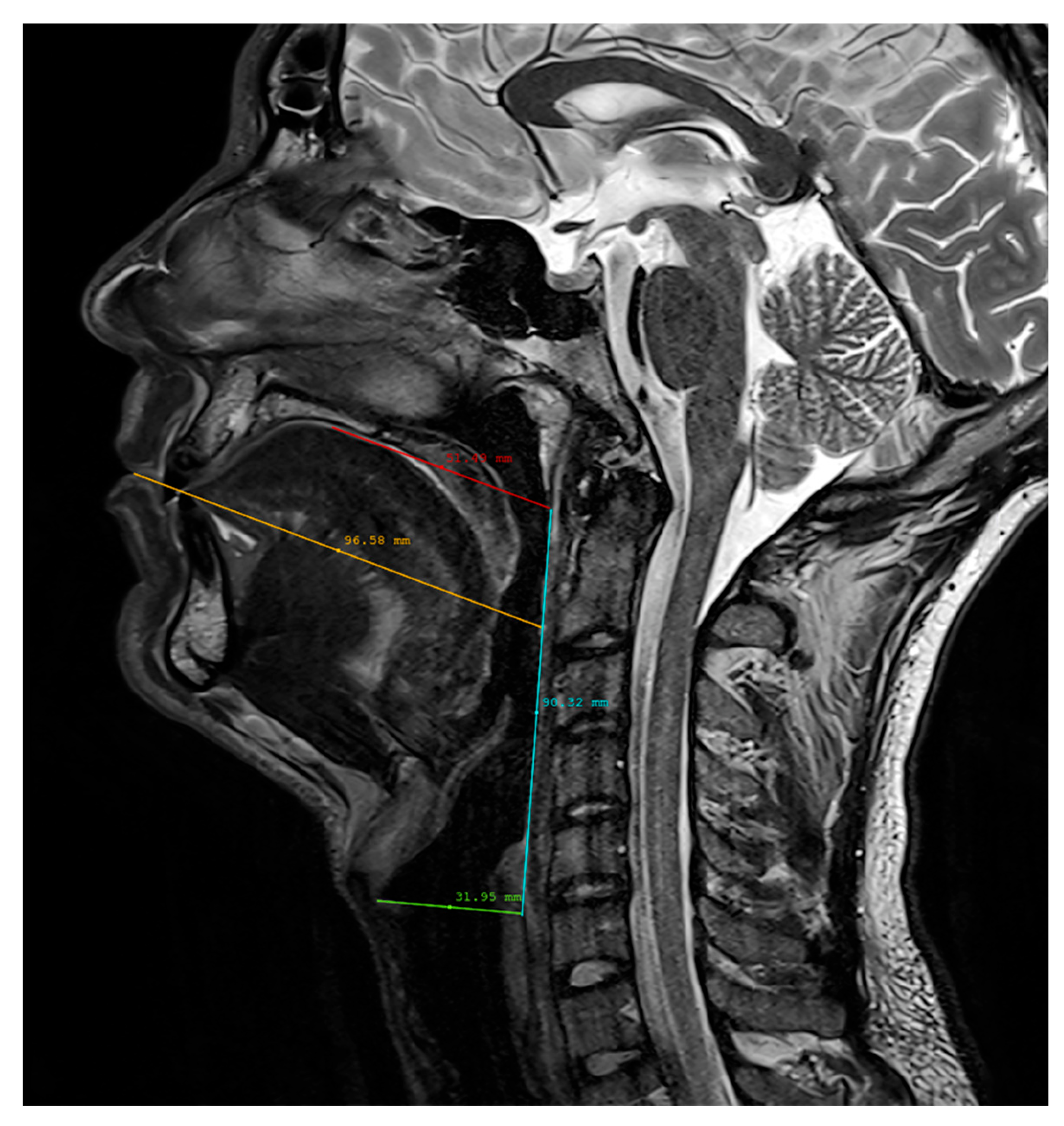 Jimaging 08 00227 g005 550