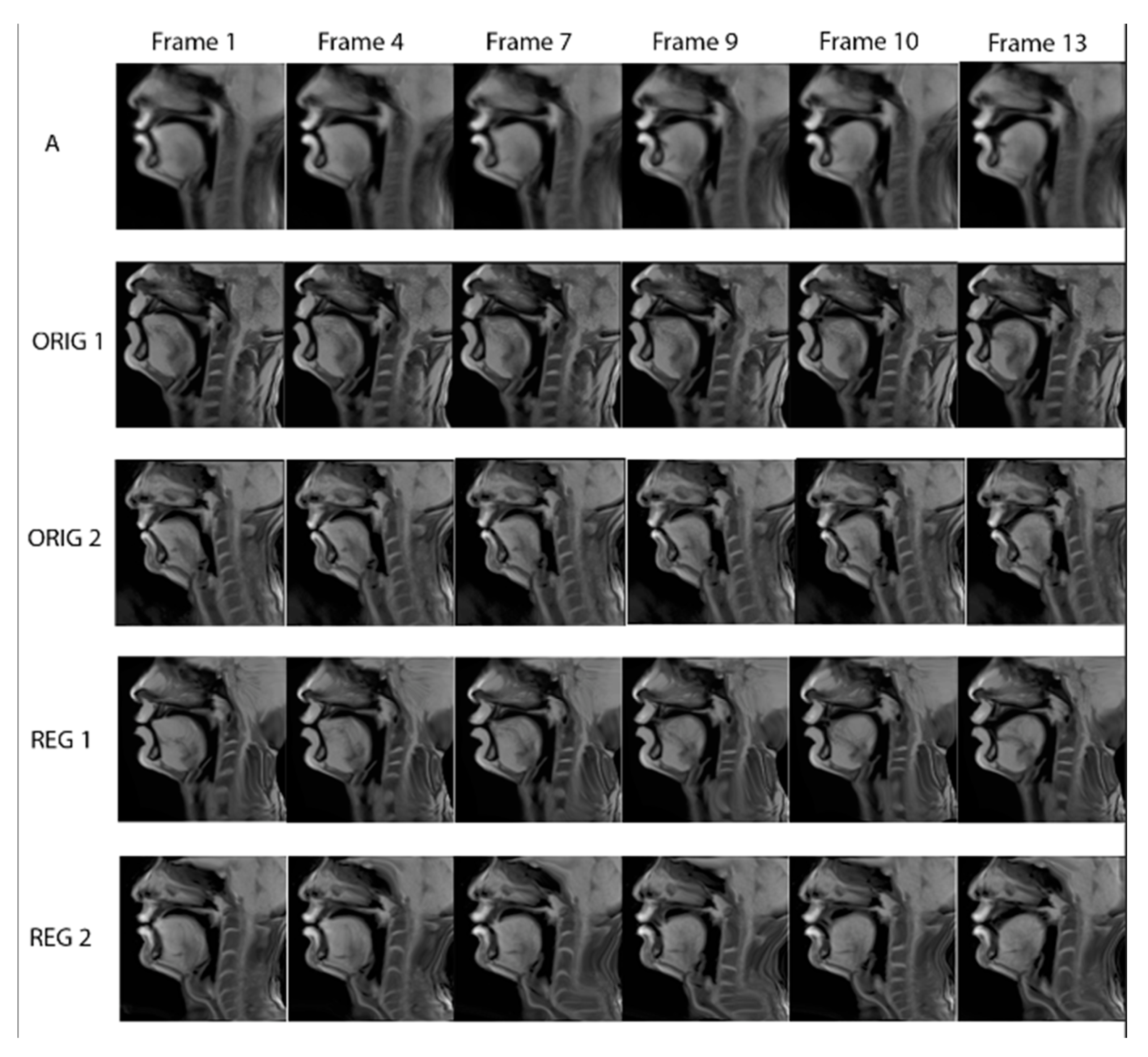 Jimaging 08 00227 g011 550