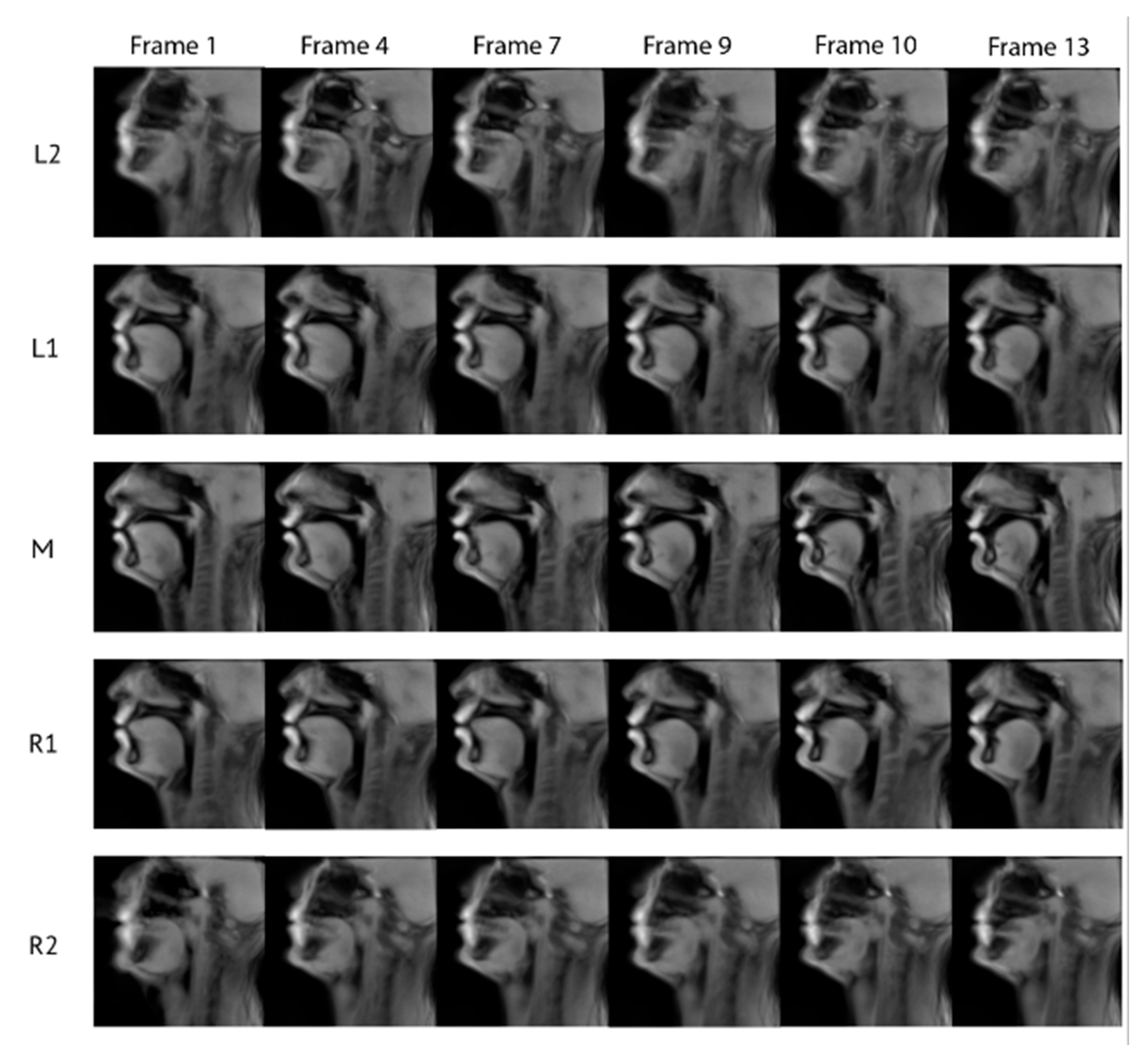 Jimaging 08 00227 g012 550