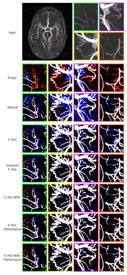 Computer Vision and Image Processing