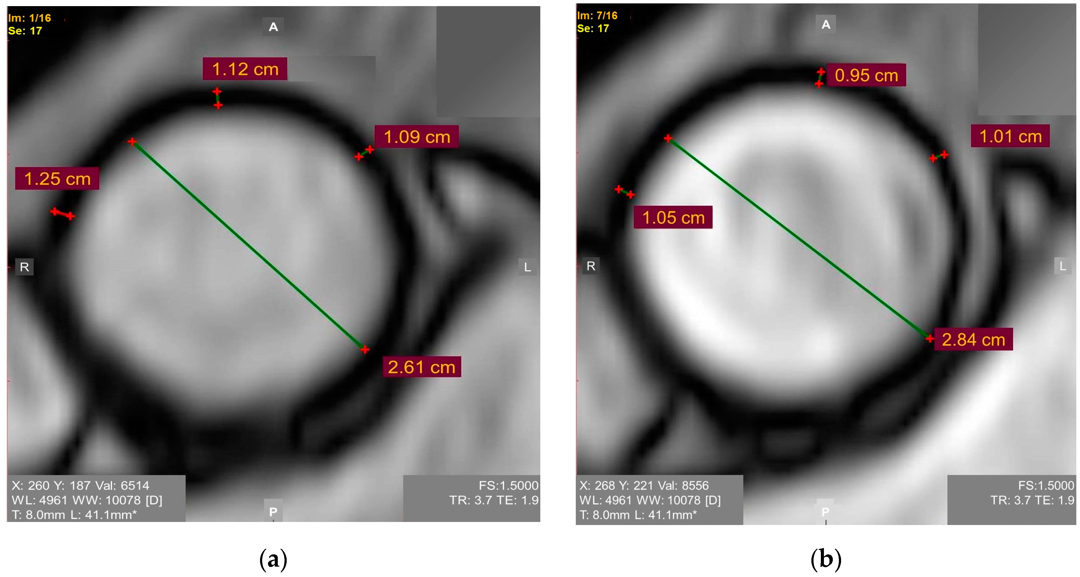 J Imaging Free Full Text Existing And Emerging Approaches To Risk j-imaging-free-full-text-existing-and-emerging-approaches-to-risk