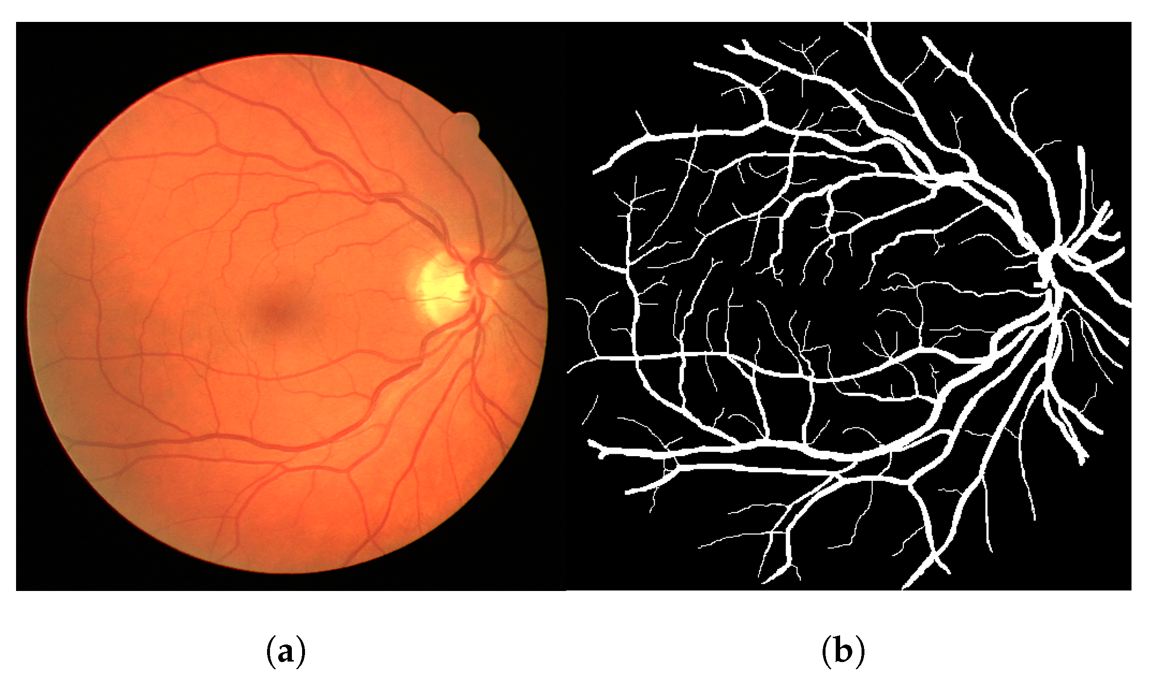 Local-Sensitive Connectivity Filter (LS-CF): A Post-Processing ...