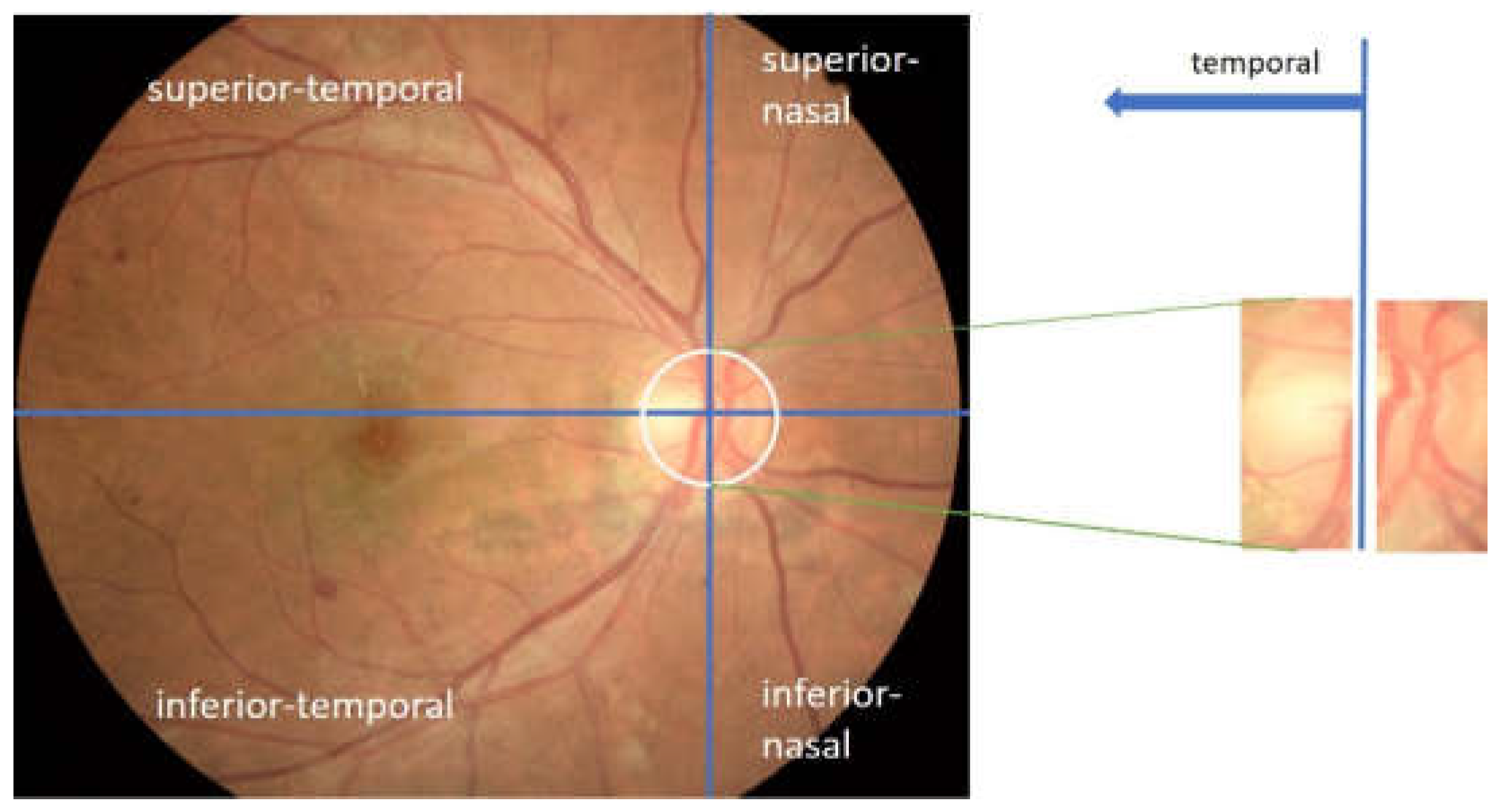 Jimaging 08 00313 g004 Jimaging 08 00313 g004