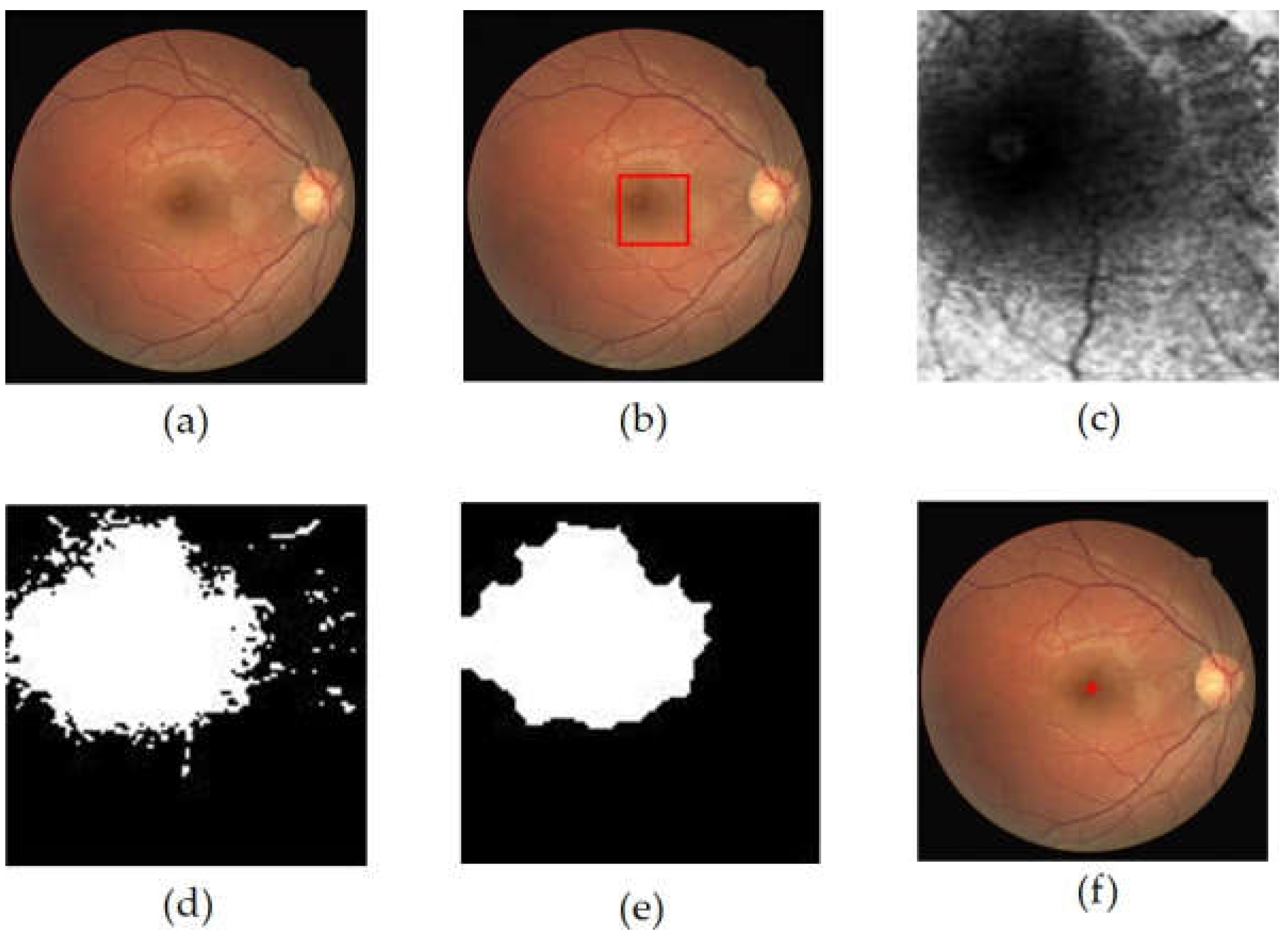 Jimaging 08 00313 g007 Jimaging 08 00313 g007