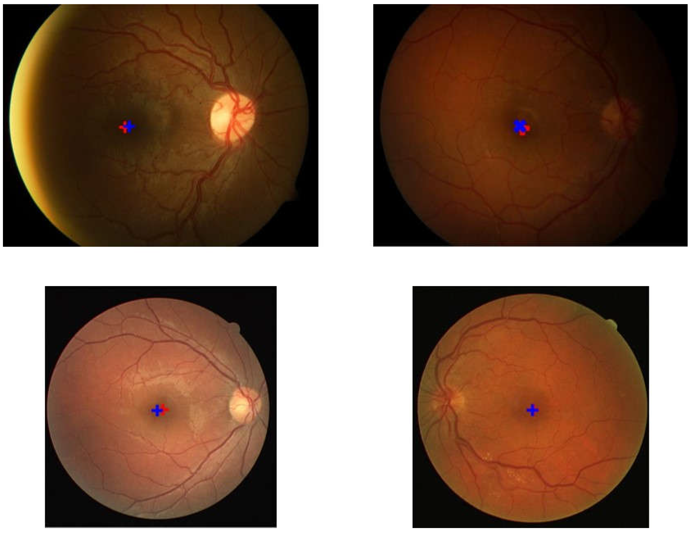 Jimaging 08 00313 g009 Jimaging 08 00313 g009