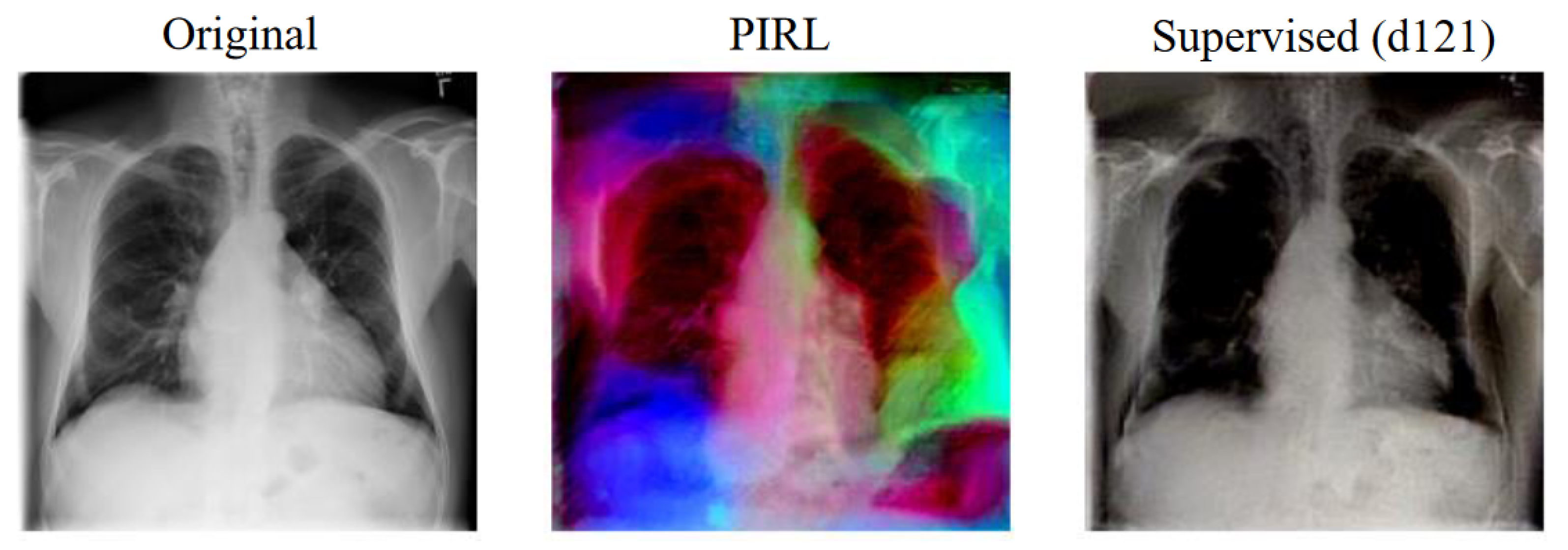 Jimaging 08 00320 g006 Jimaging 08 00320 g006