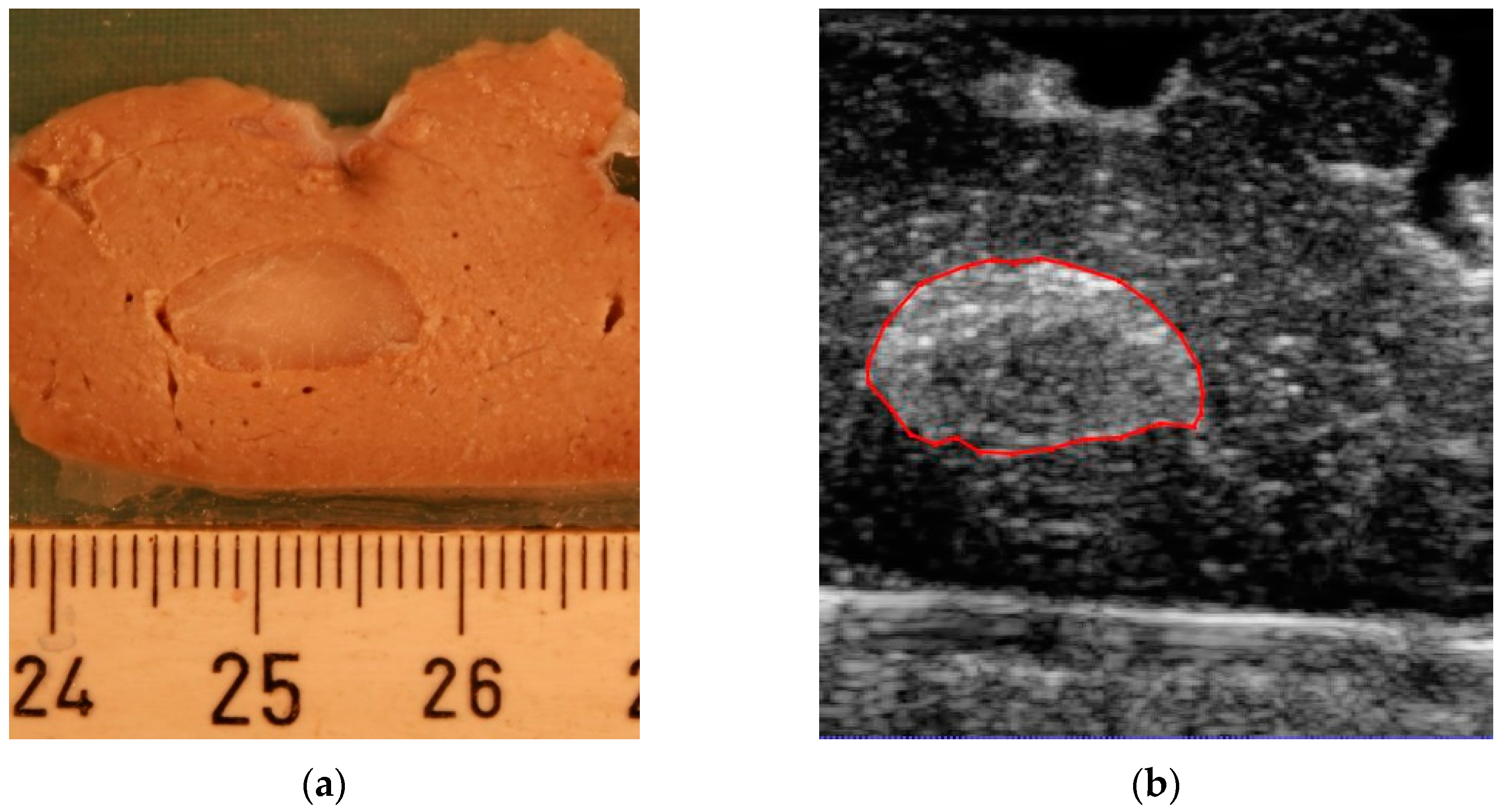 Jimaging 08 00329 g003a