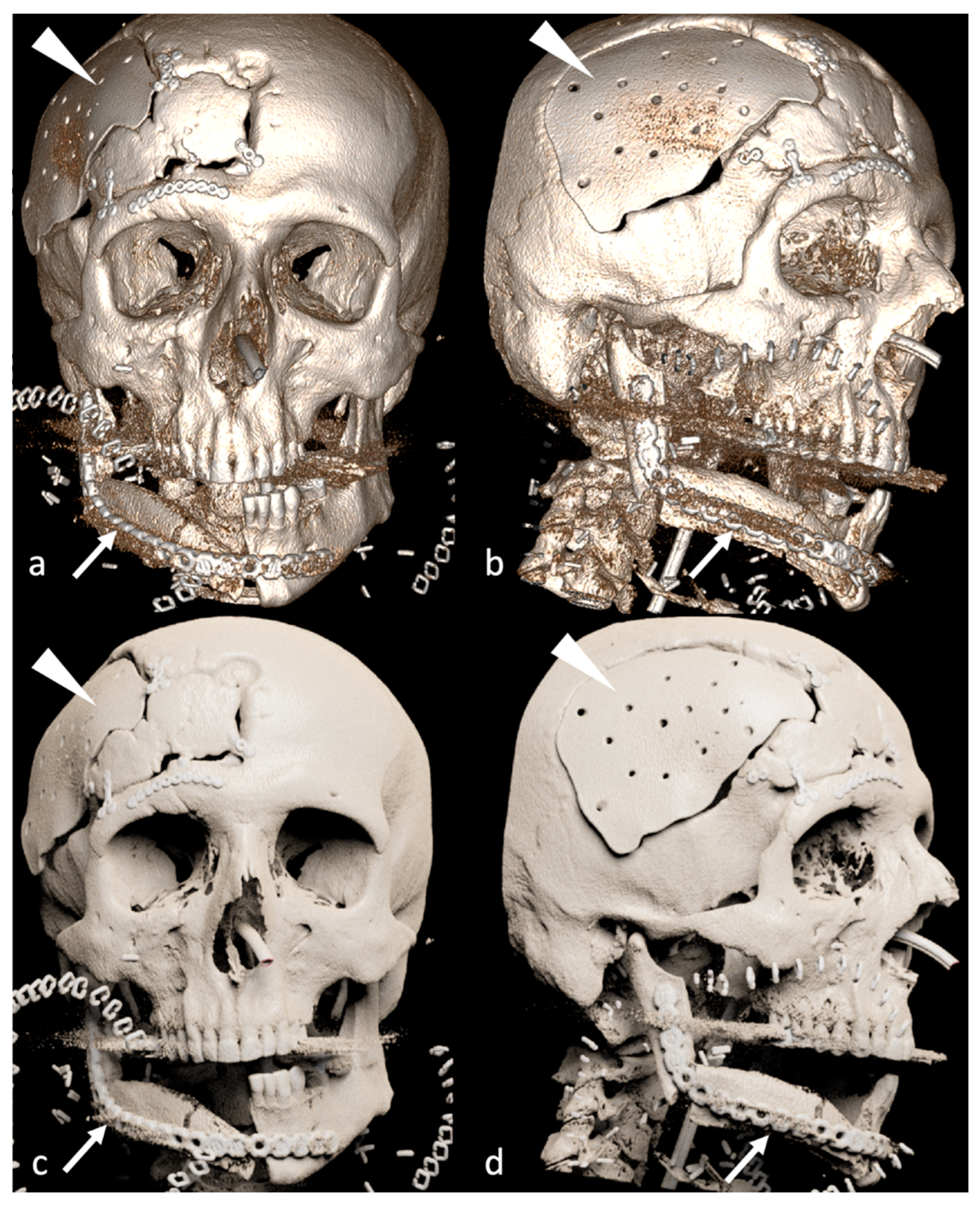 Jimaging 09 00024 g002 Jimaging 09 00024 g002