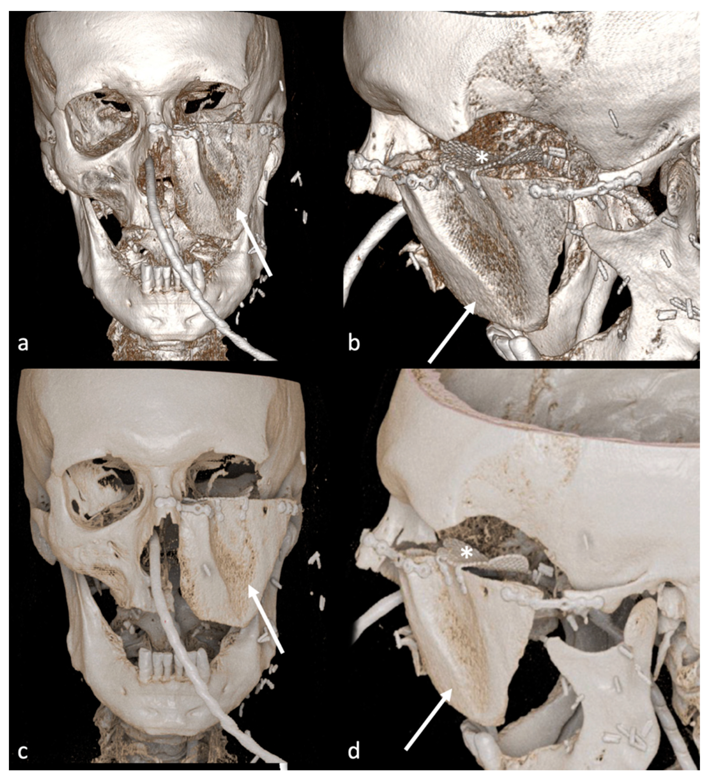 Jimaging 09 00024 g003 Jimaging 09 00024 g003