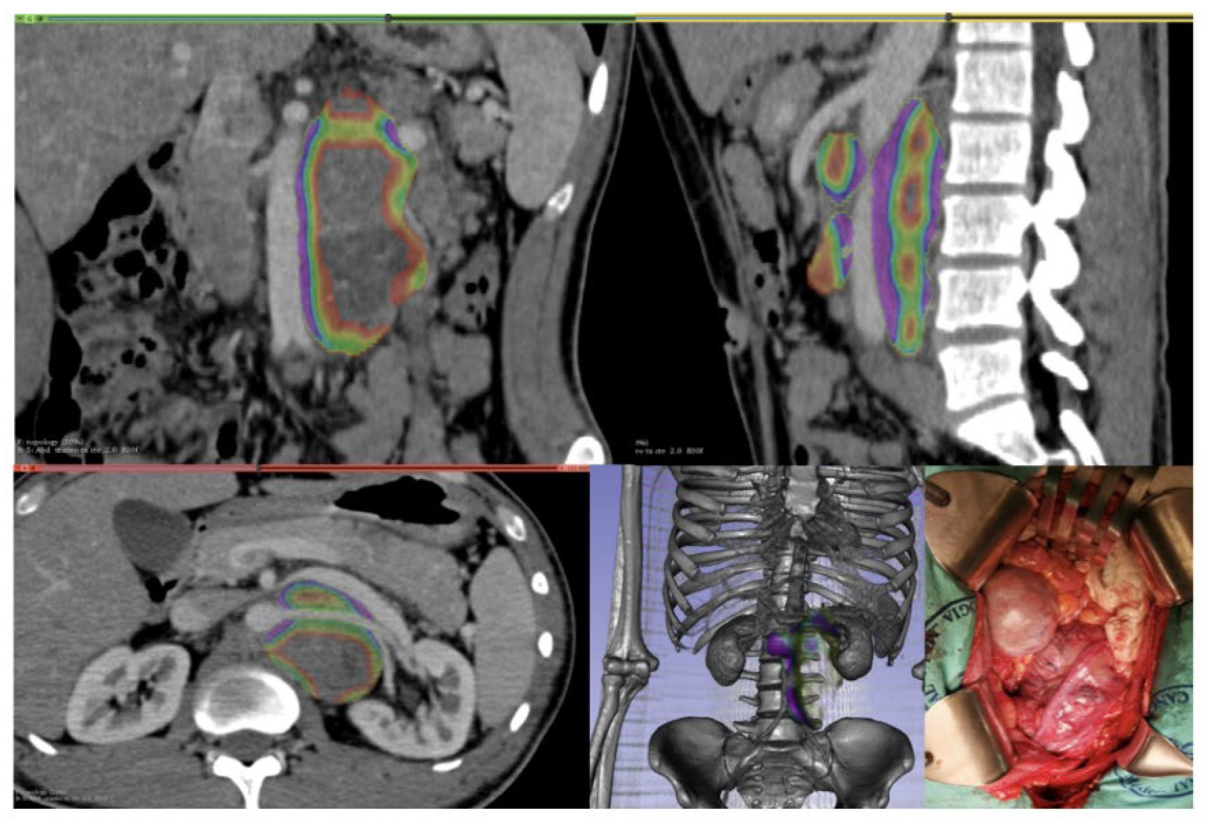 J. Imaging Free FullText CT Rendering and Radiomic Analysis in