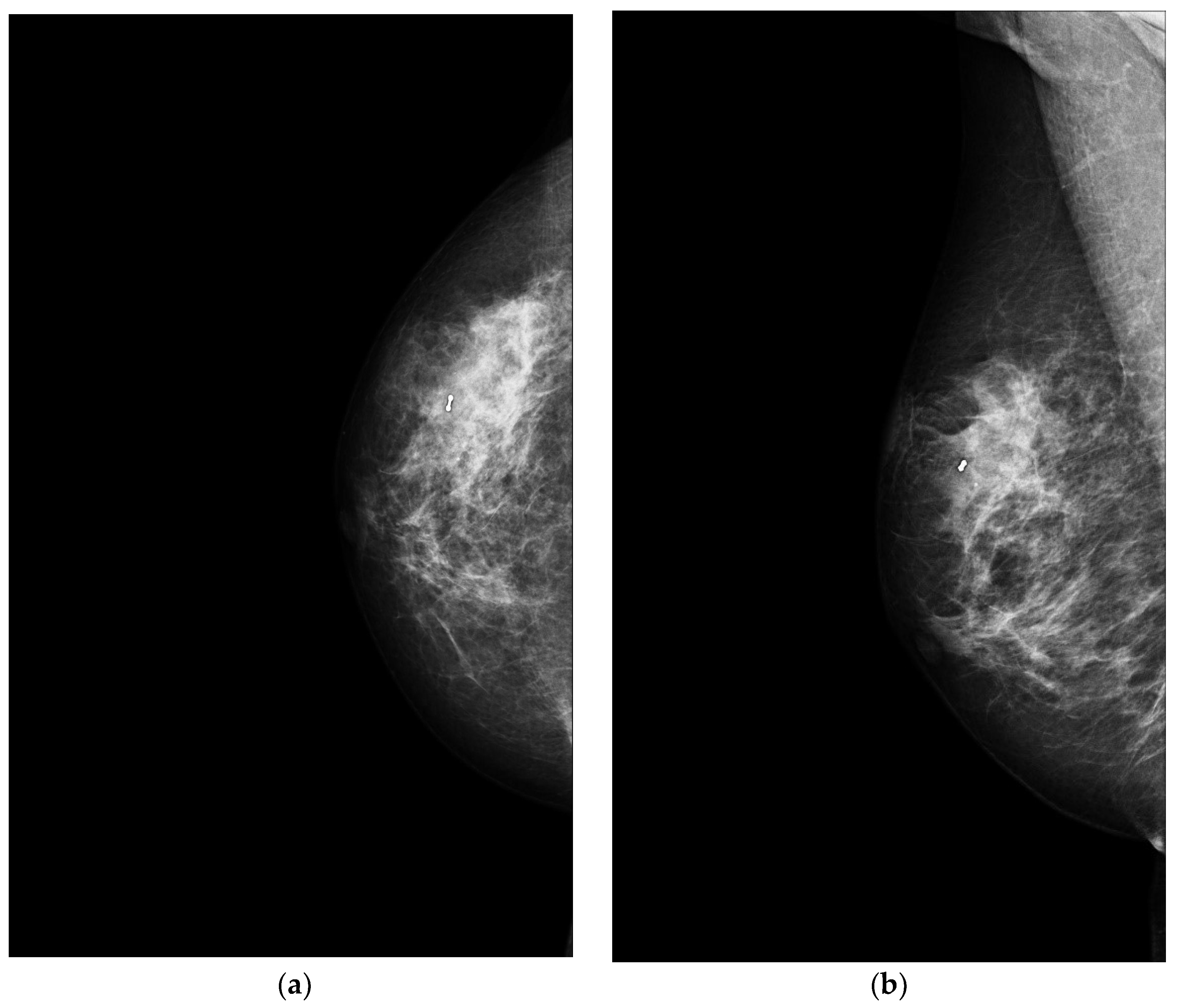 Jimaging 09 00094 g002 Jimaging 09 00094 g002