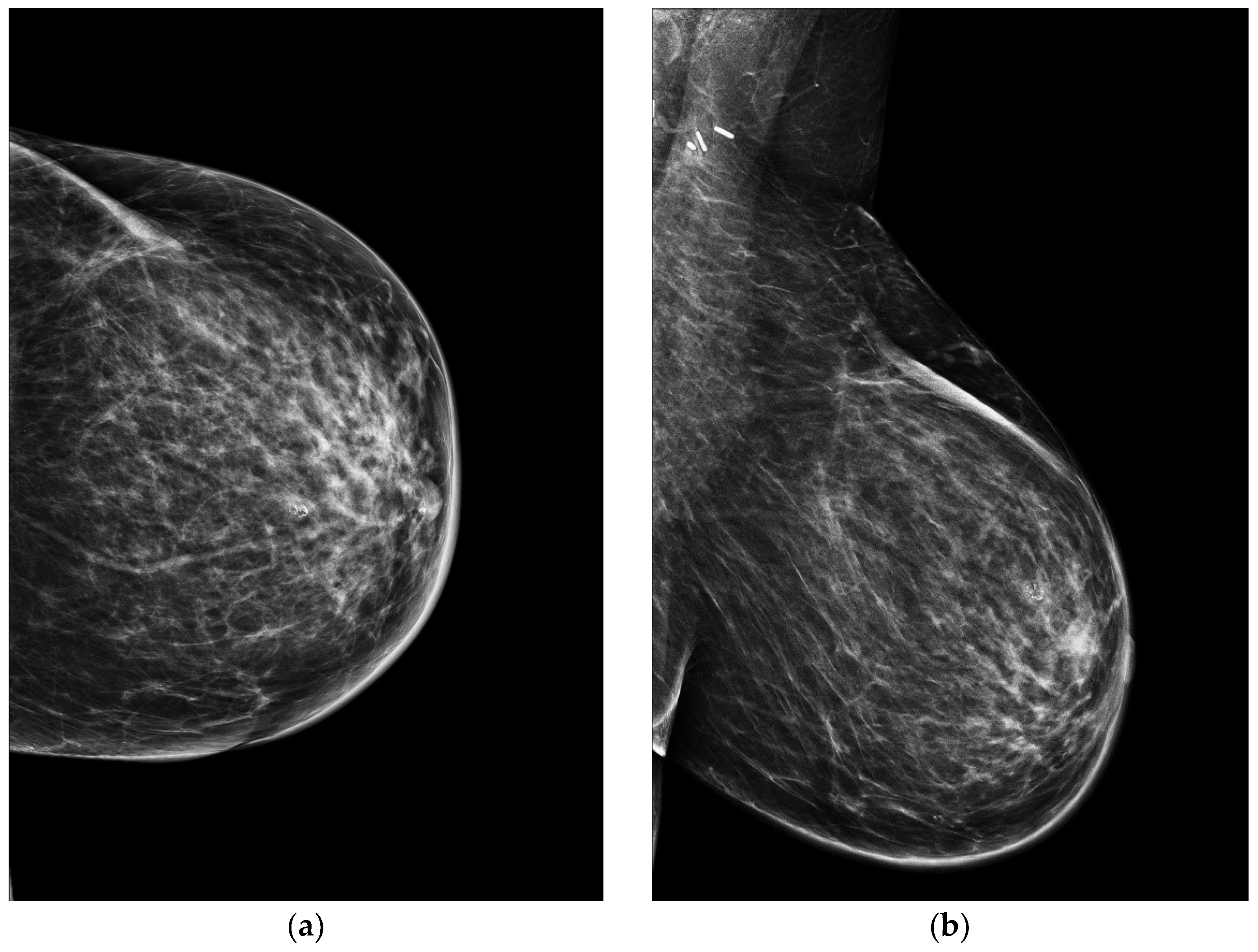 Jimaging 09 00094 g004 Jimaging 09 00094 g004