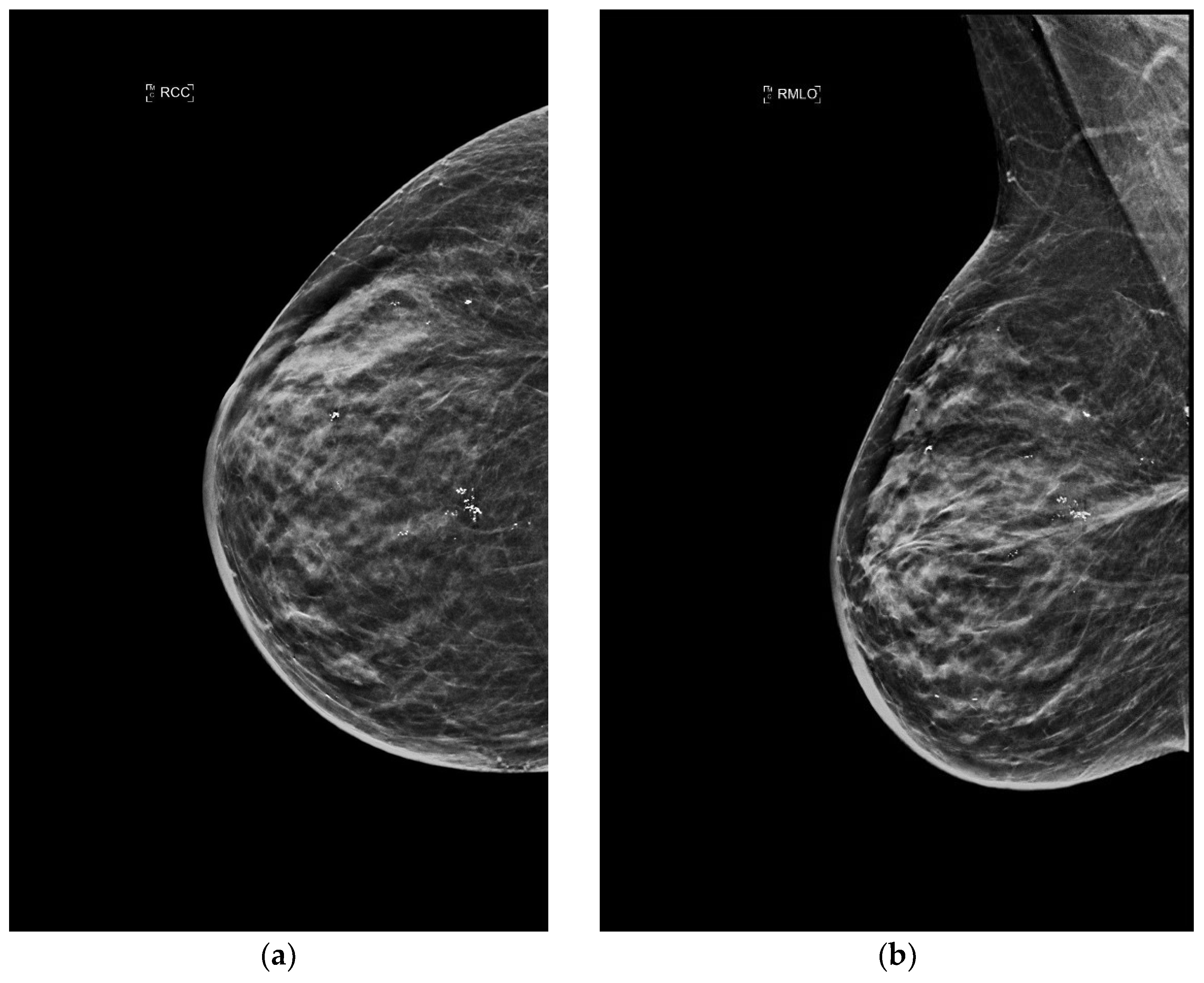 Jimaging 09 00094 g005 Jimaging 09 00094 g005