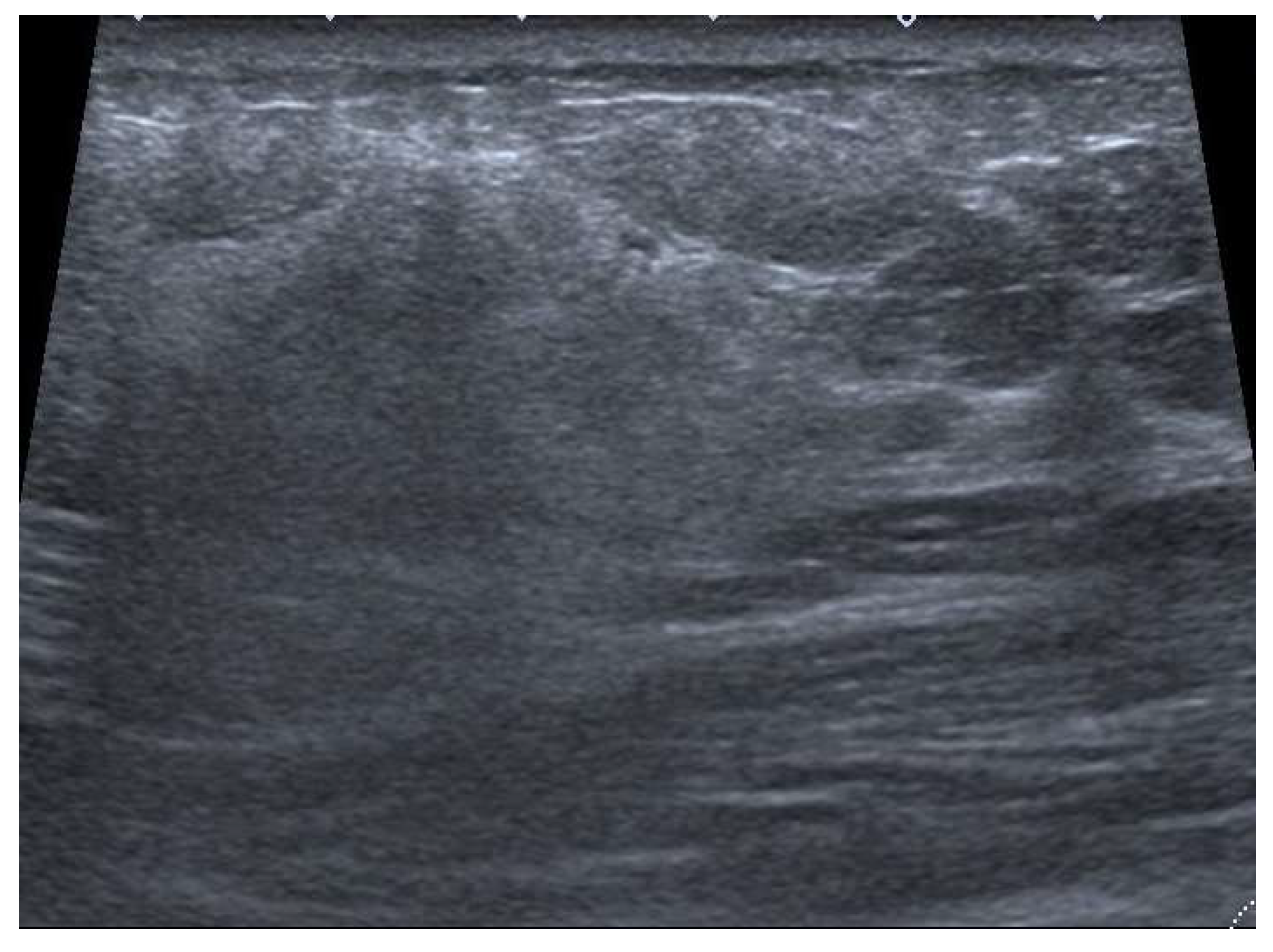 Jimaging 09 00094 g006 Jimaging 09 00094 g006