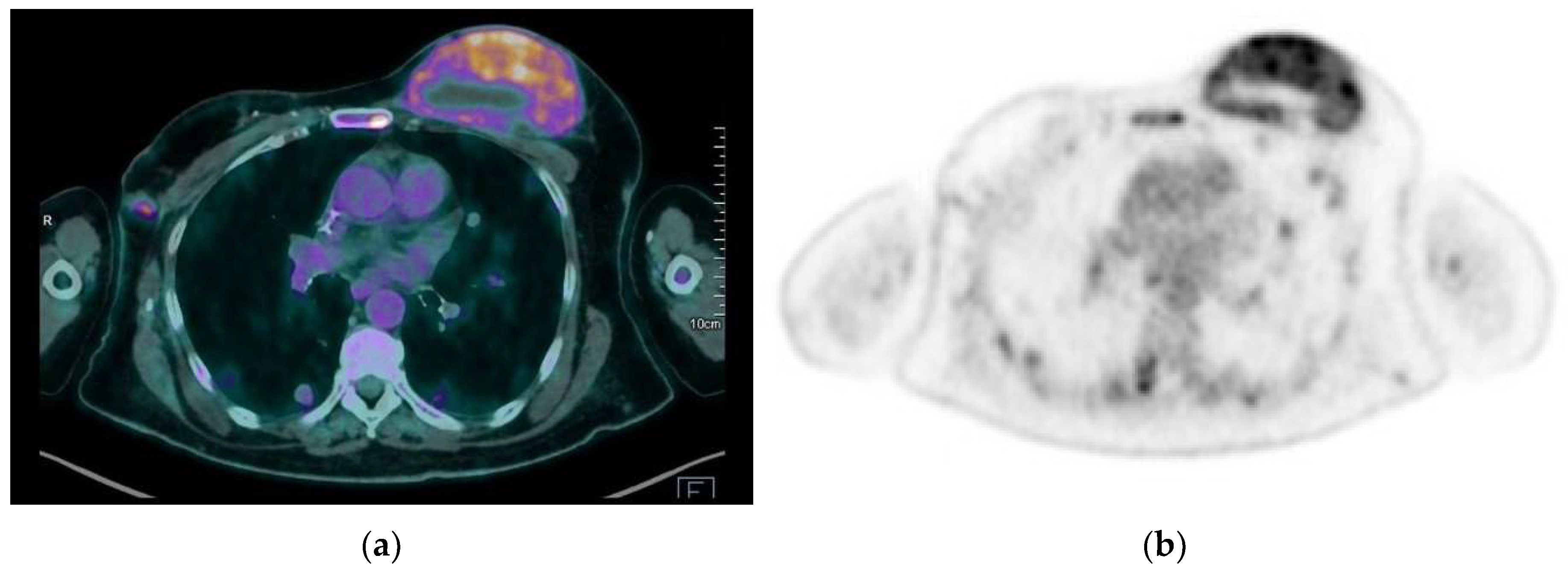 Jimaging 09 00094 g014 Jimaging 09 00094 g014