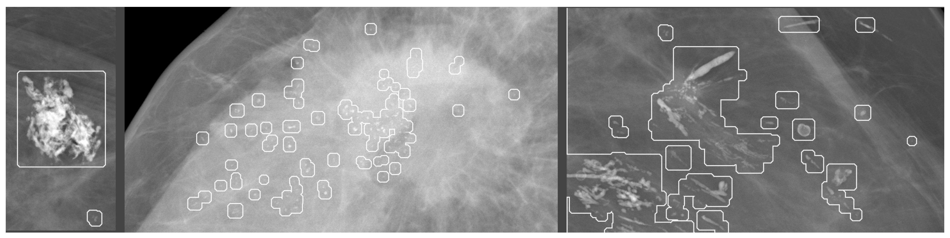 Jimaging 09 00095 g005