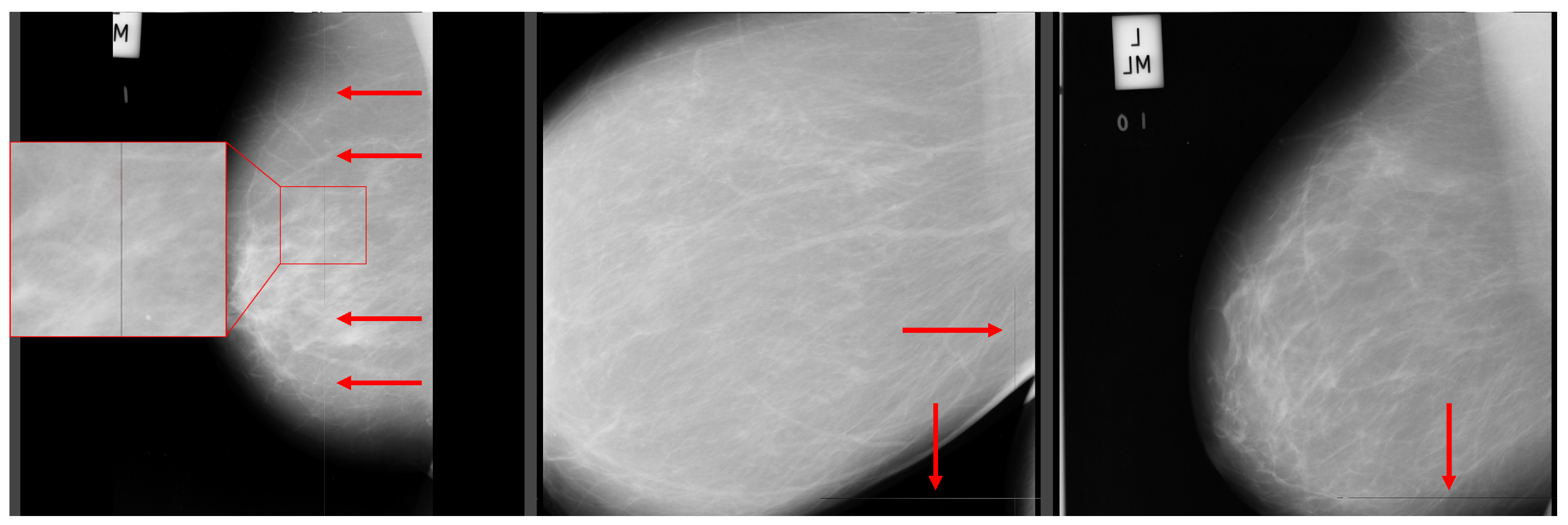 Jimaging 09 00095 g014