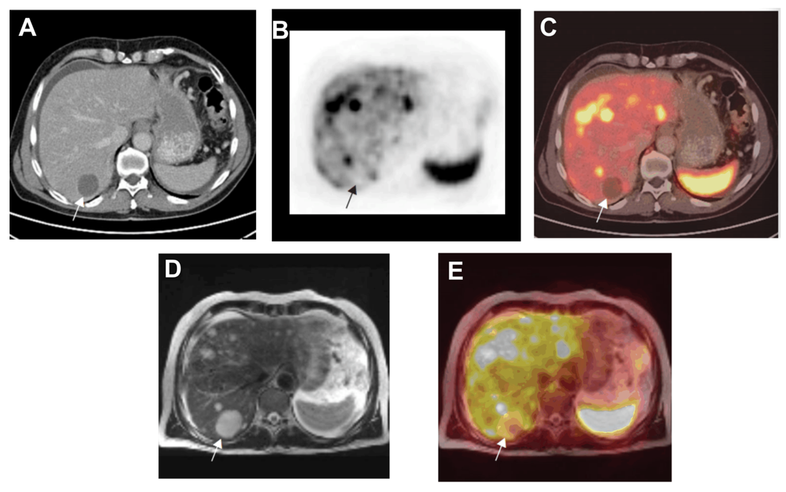 Jimaging 09 00115 g005