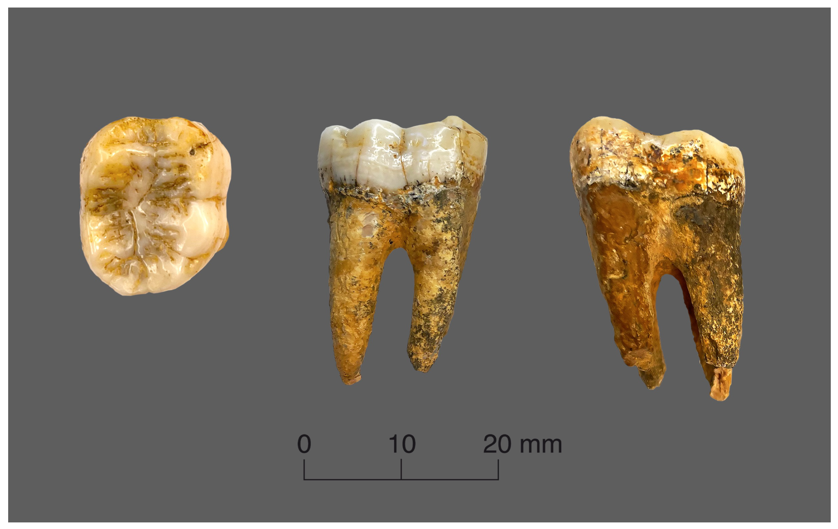 J. Imaging | Free Full-Text | Measuring Dental Enamel Thickness:  Morphological and Functional Relevance of Topographic Mapping
