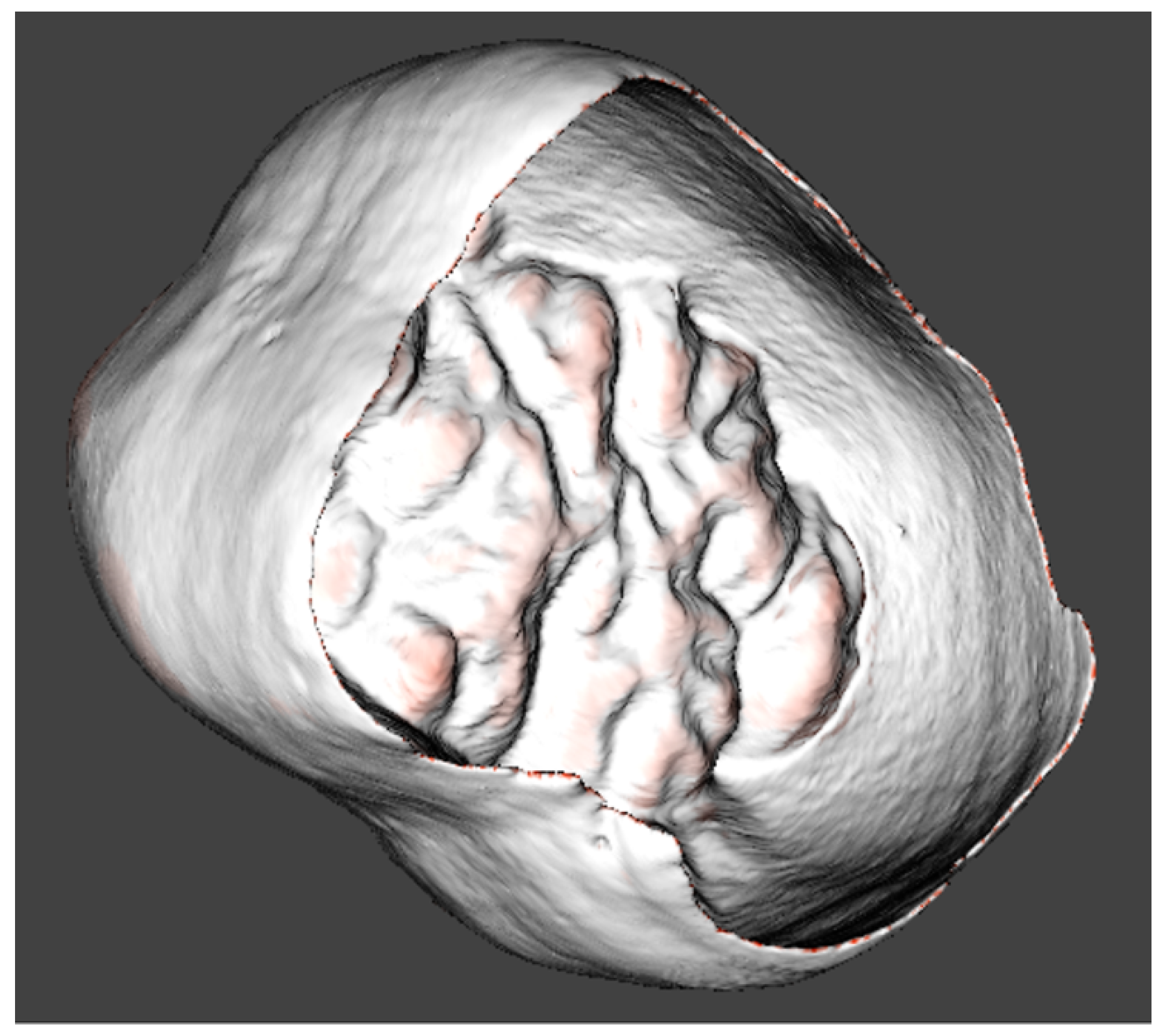 Jimaging 09 00127 g004