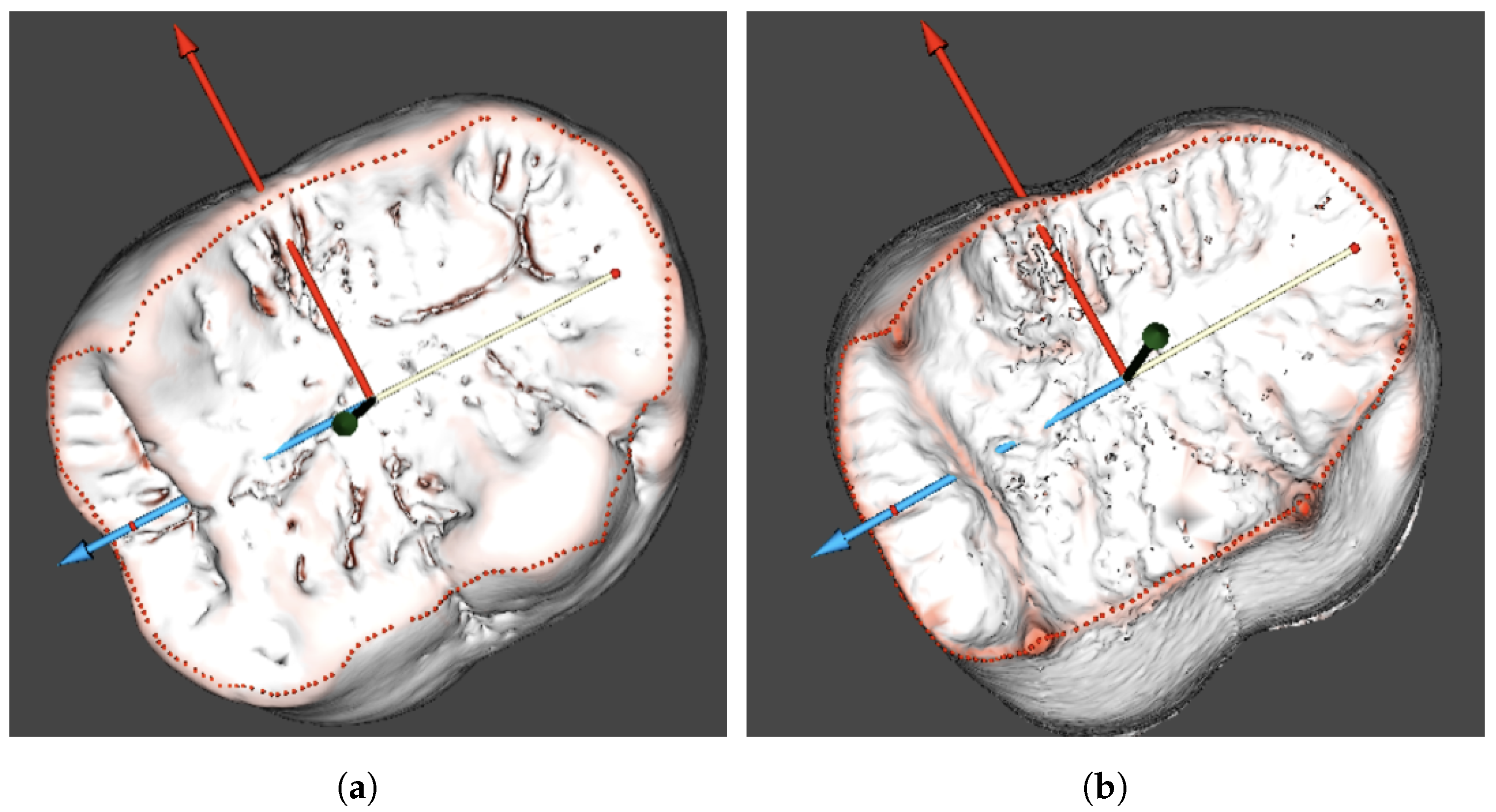 Jimaging 09 00127 g005