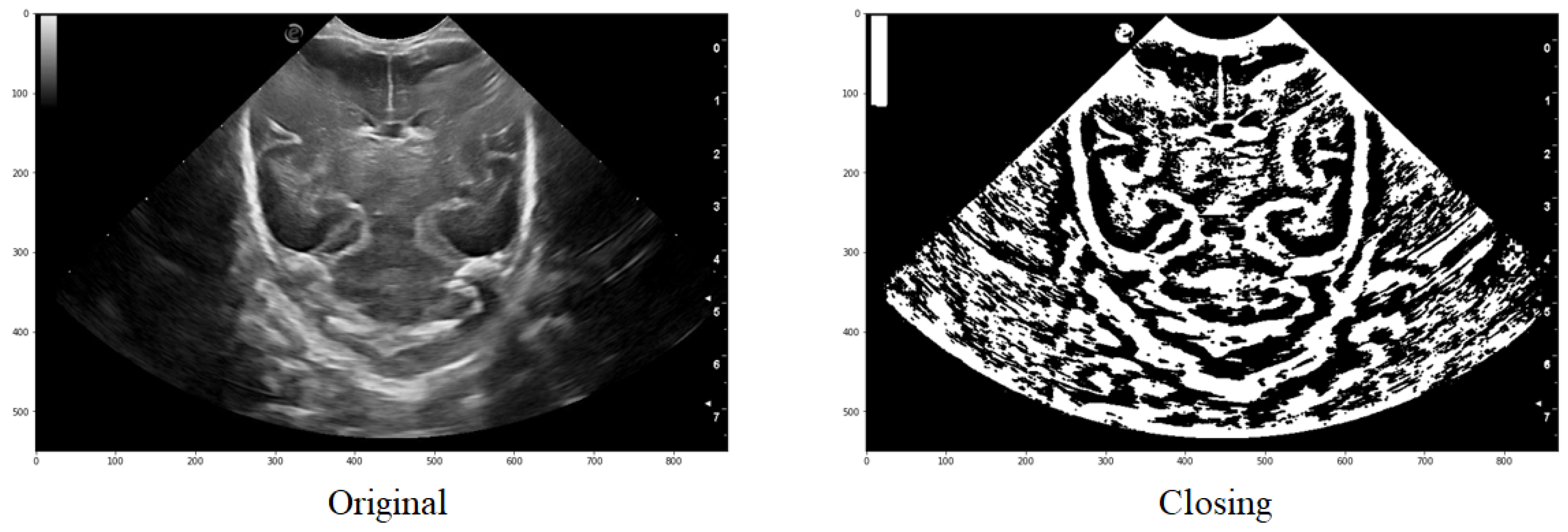 Jimaging 09 00145 g008