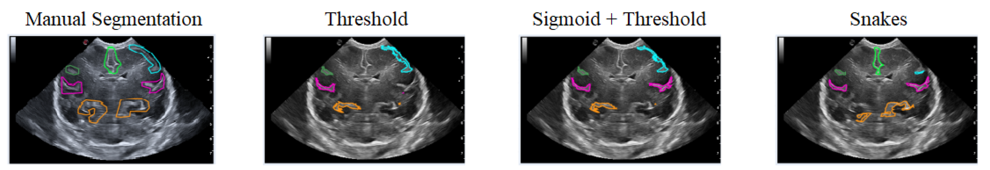 Jimaging 09 00145 g016