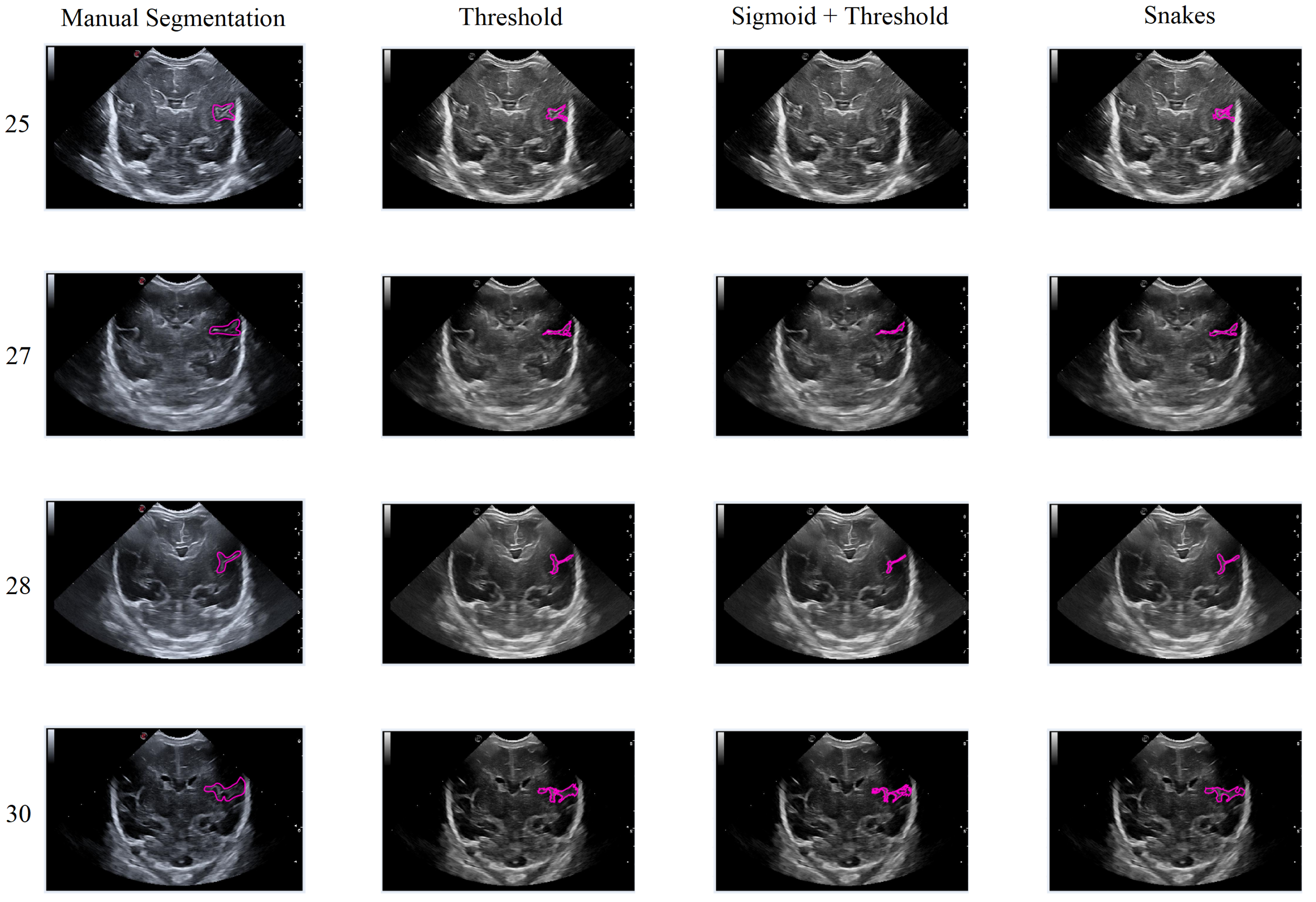 Jimaging 09 00145 g017