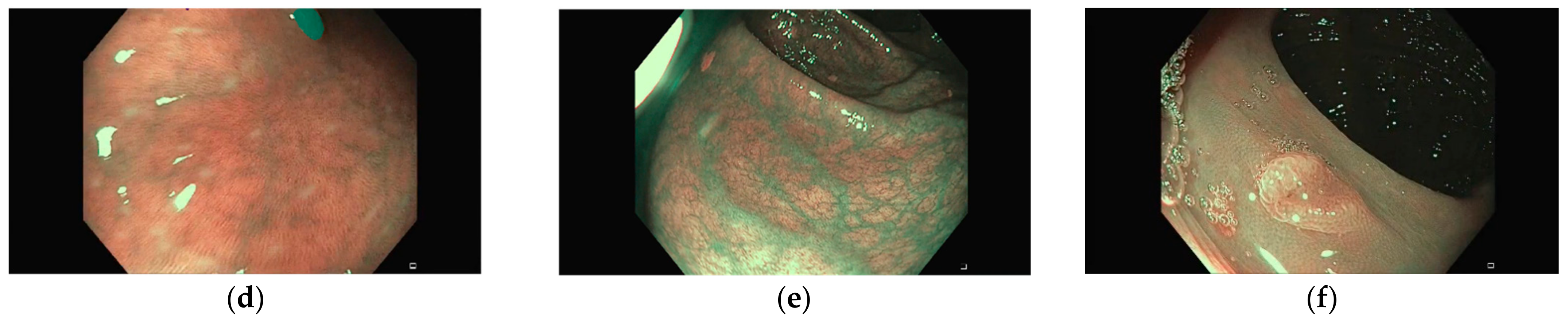 Jimaging 09 00167 g001b