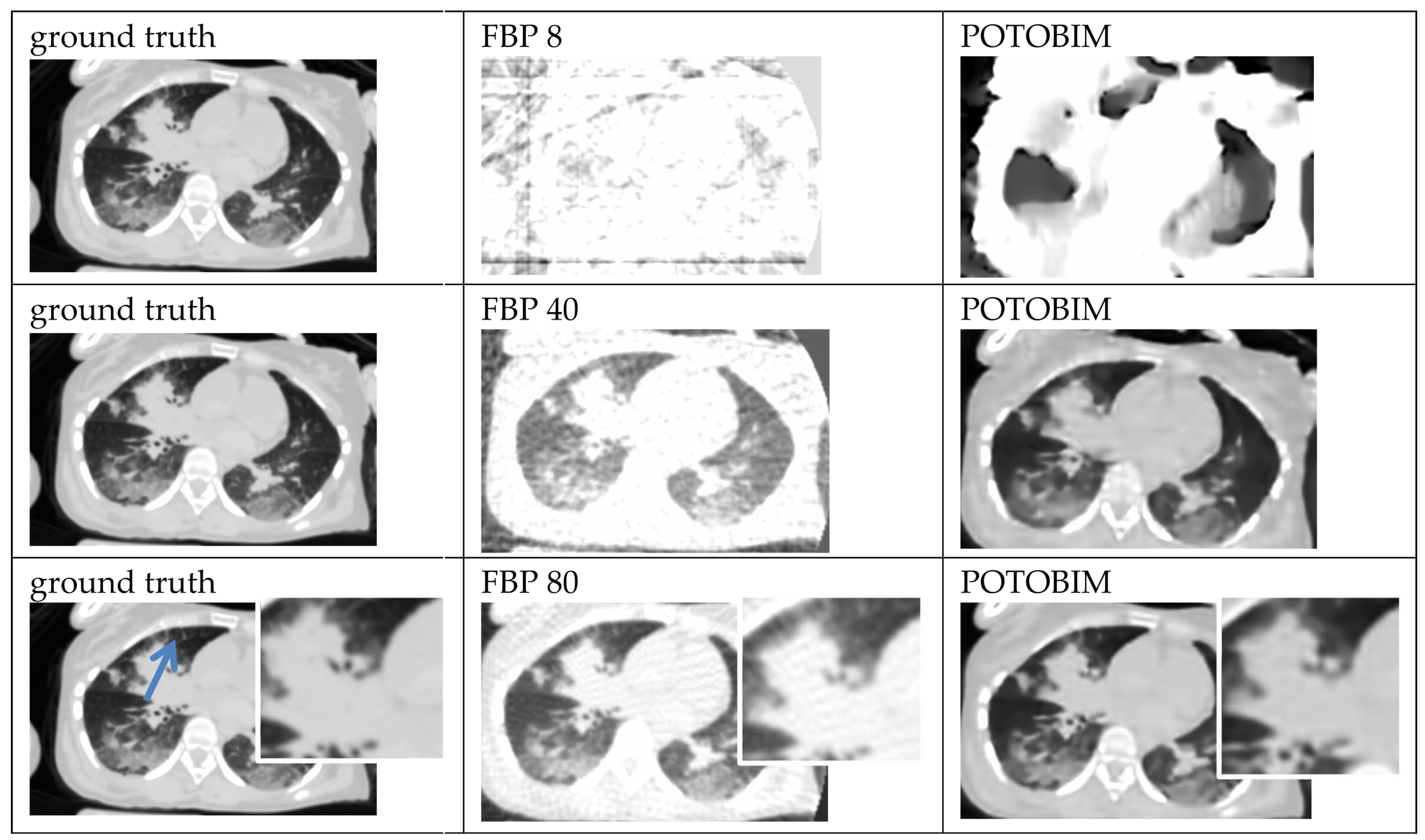 Bayesian Reconstruction Algorithms for Low-Dose Computed Tomography Are ...