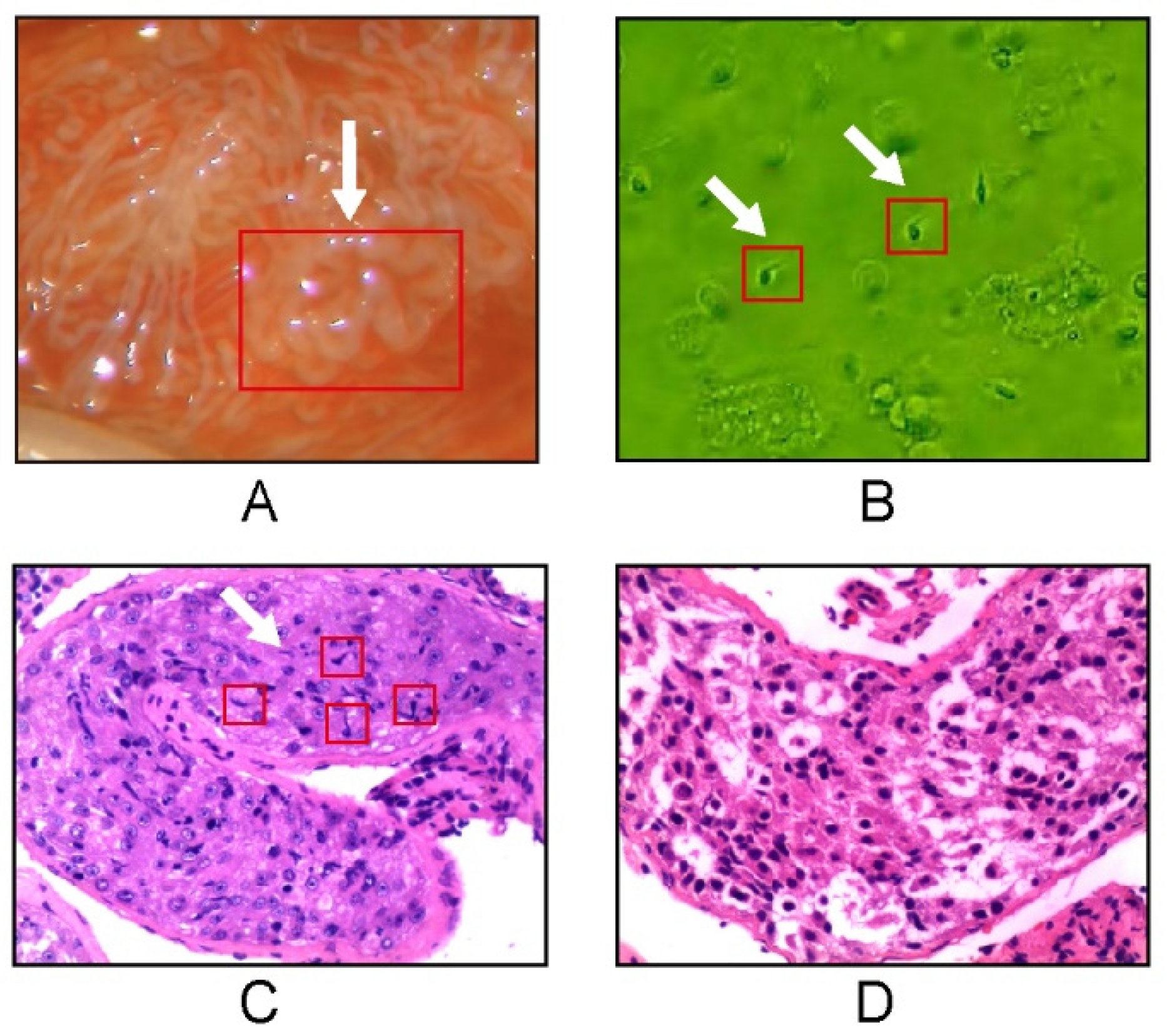 J. Imaging Free FullText Noninvasive Prediction of Sperm Retrieval
