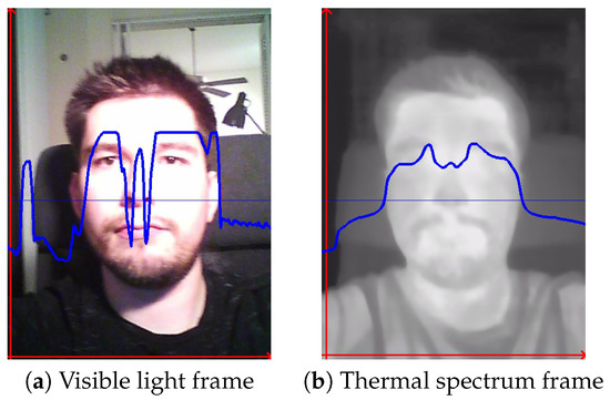 Thermal Image Processing for Respiratory Estimation from Cubical Data ...