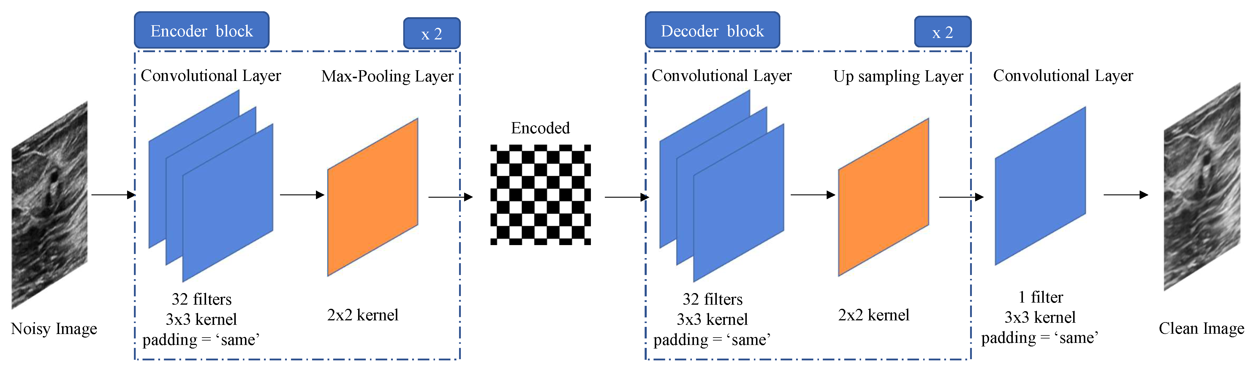 J. Imaging | Free Full-Text | Make It Less Complex: Autoencoder for ...