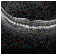 Jimaging 09 00219 i014