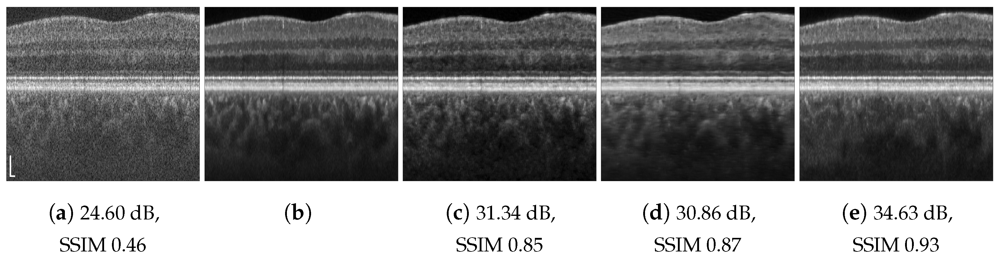 Jimaging 09 00237 g005