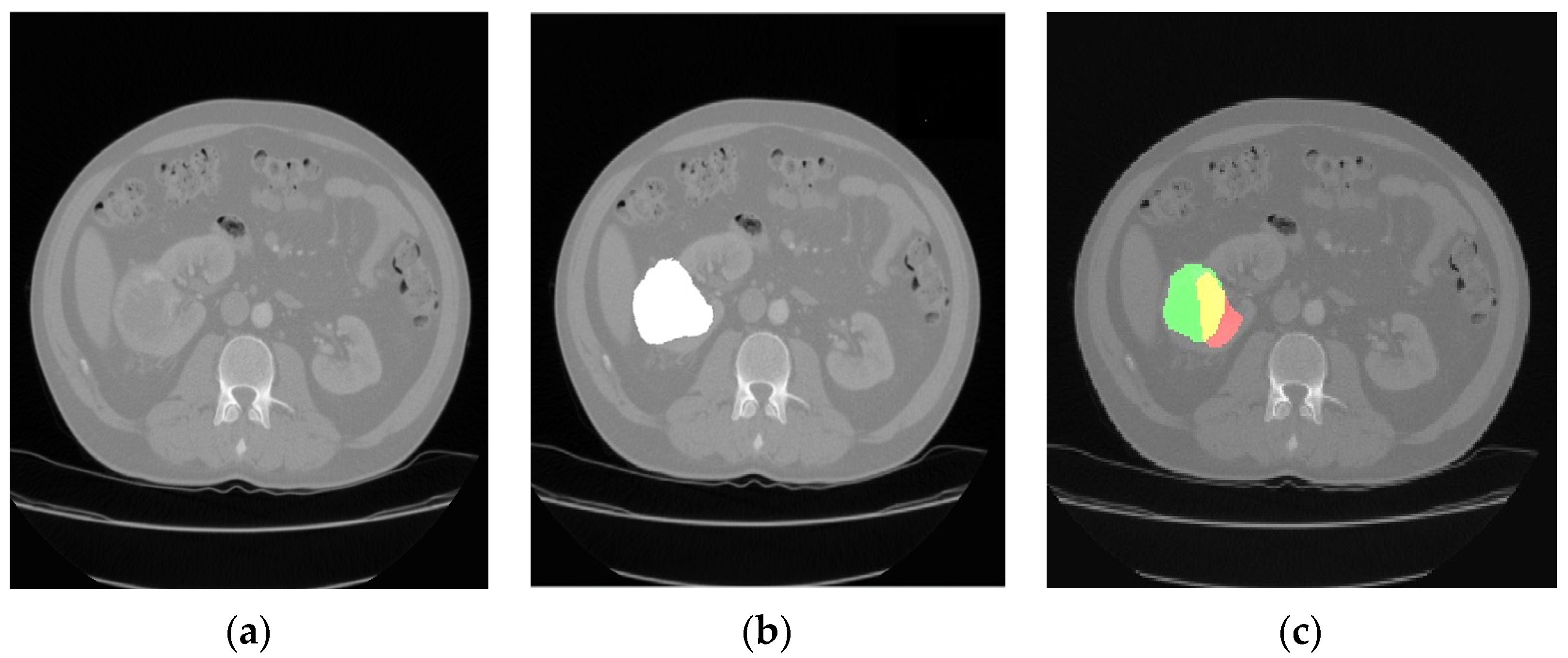 Jimaging 09 00280 g004
