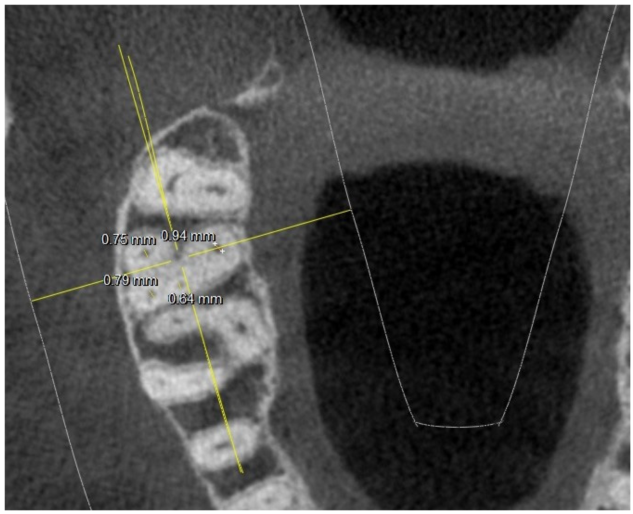 Jimaging 10 00009 g005