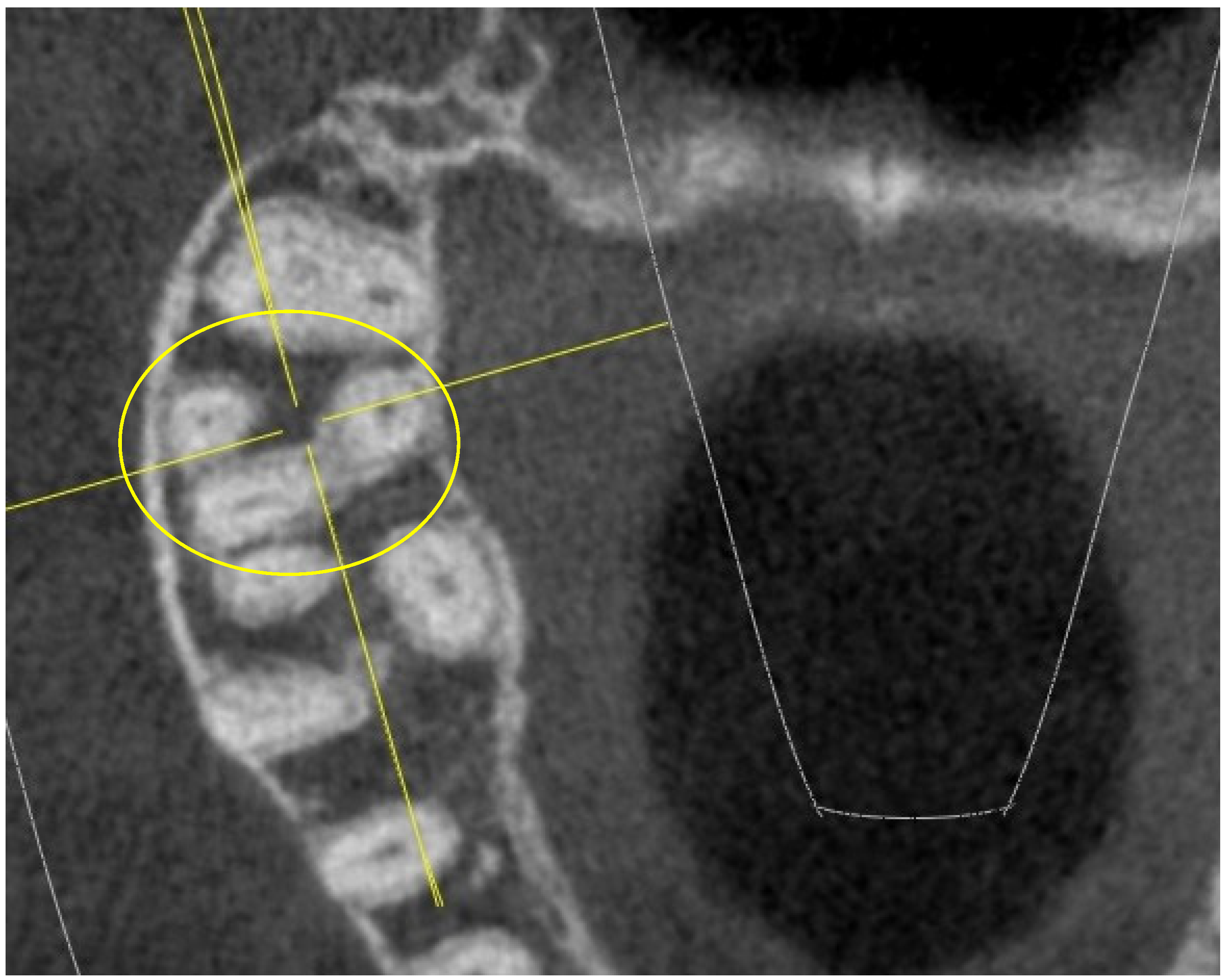 Jimaging 10 00009 g006